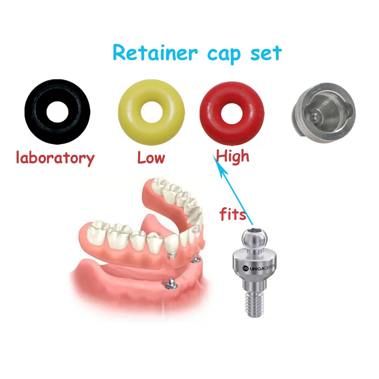 Hiossen/Osstem Dental O-ring Retainer Cap Set Kit for Ball Attachment Abutments
