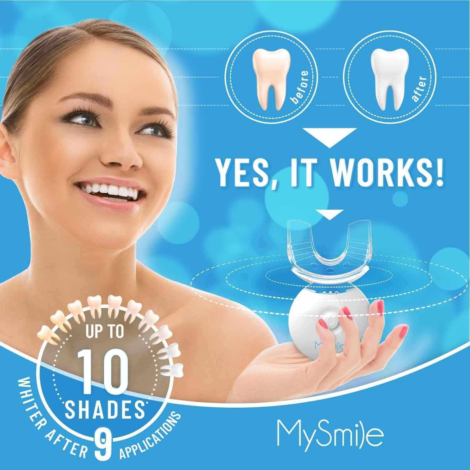 MySmile Teeth Whitening Kit with LED Light, 10 Min 3 Fl Oz (Pack of 3)