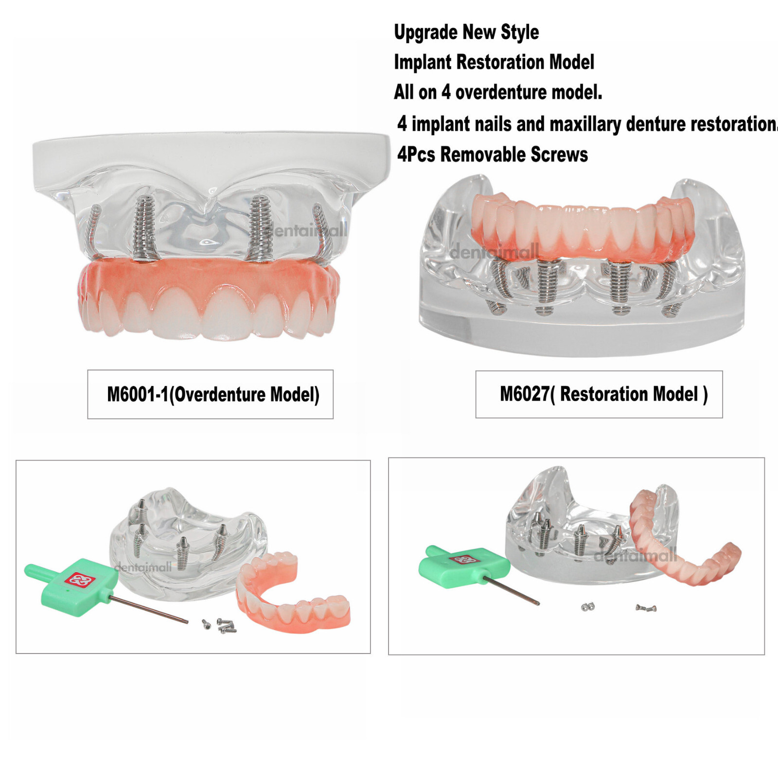 US Dental 4 Screws Overdenture Model All on 4 Restoration Upper/Lower Jaw Type