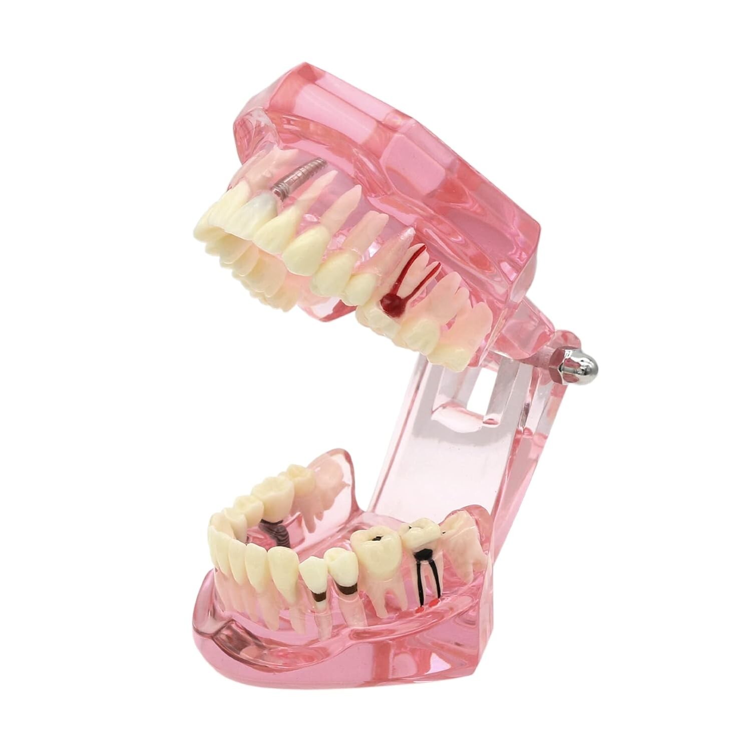 Dental Teeth Model Teach for Study Demo Restoration Pathology Bridge M2001 Pink