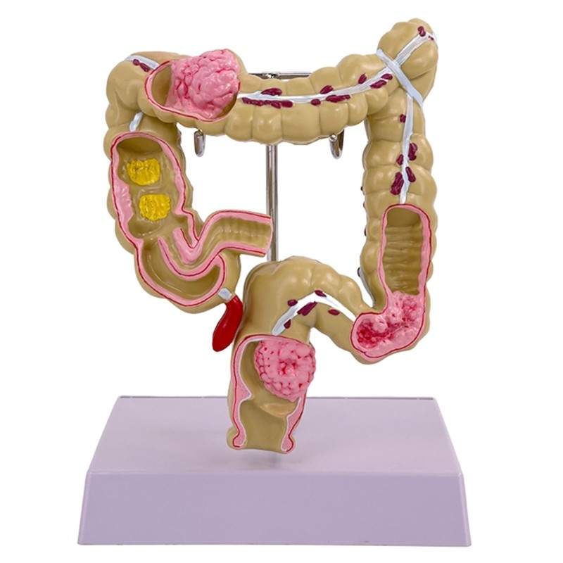 Human Large Intestine Model Teaching Model Medicals Supplies for School Study
