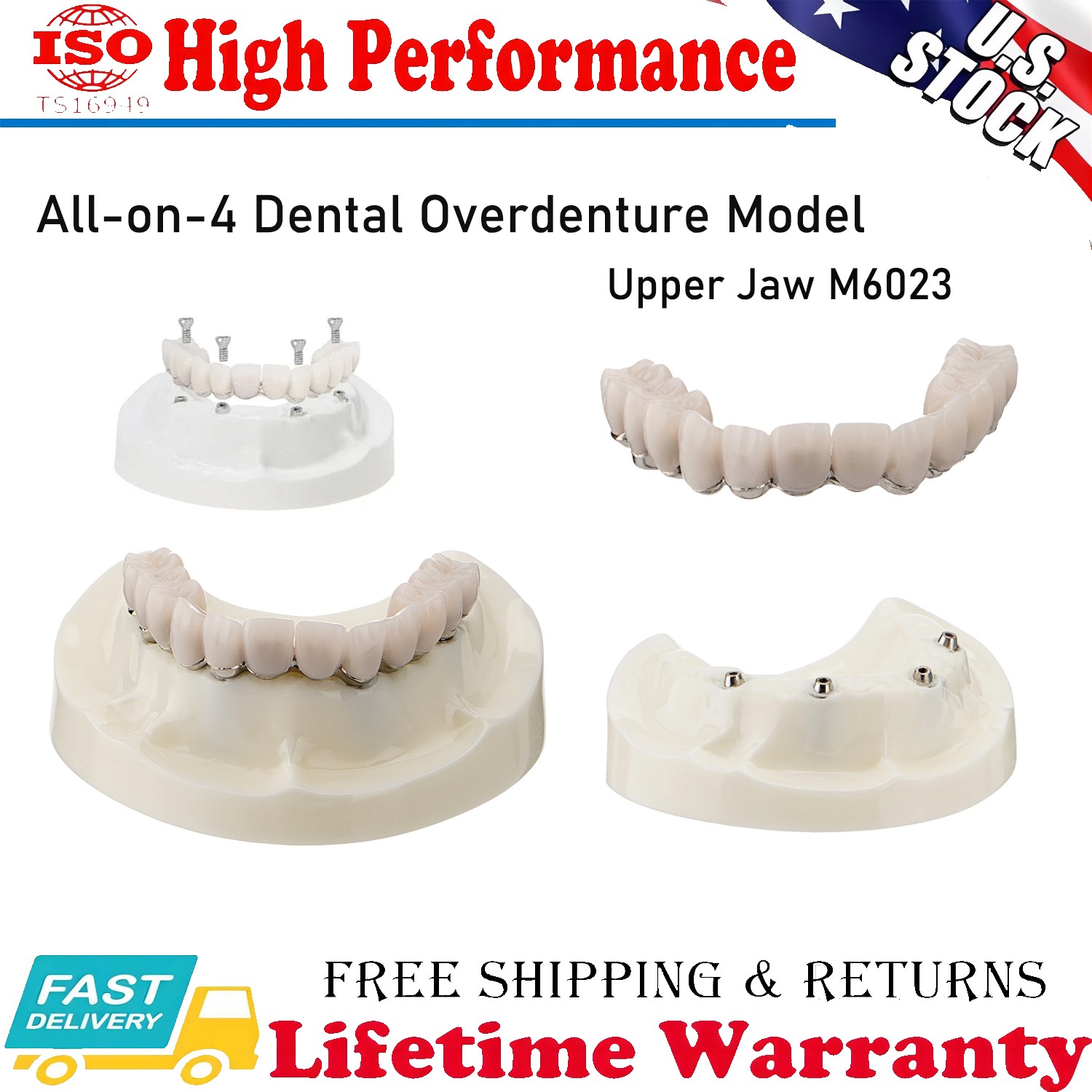 Dental Implant All-on-4 Overdenture Model Upper Jaw Restoration 4 Screws M6023 A