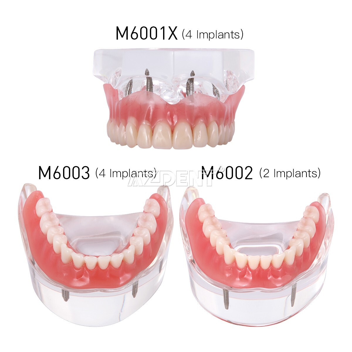 Kilgore NISSIN 200 Type Dental Typodont Model/Implant Denture Restoration Model