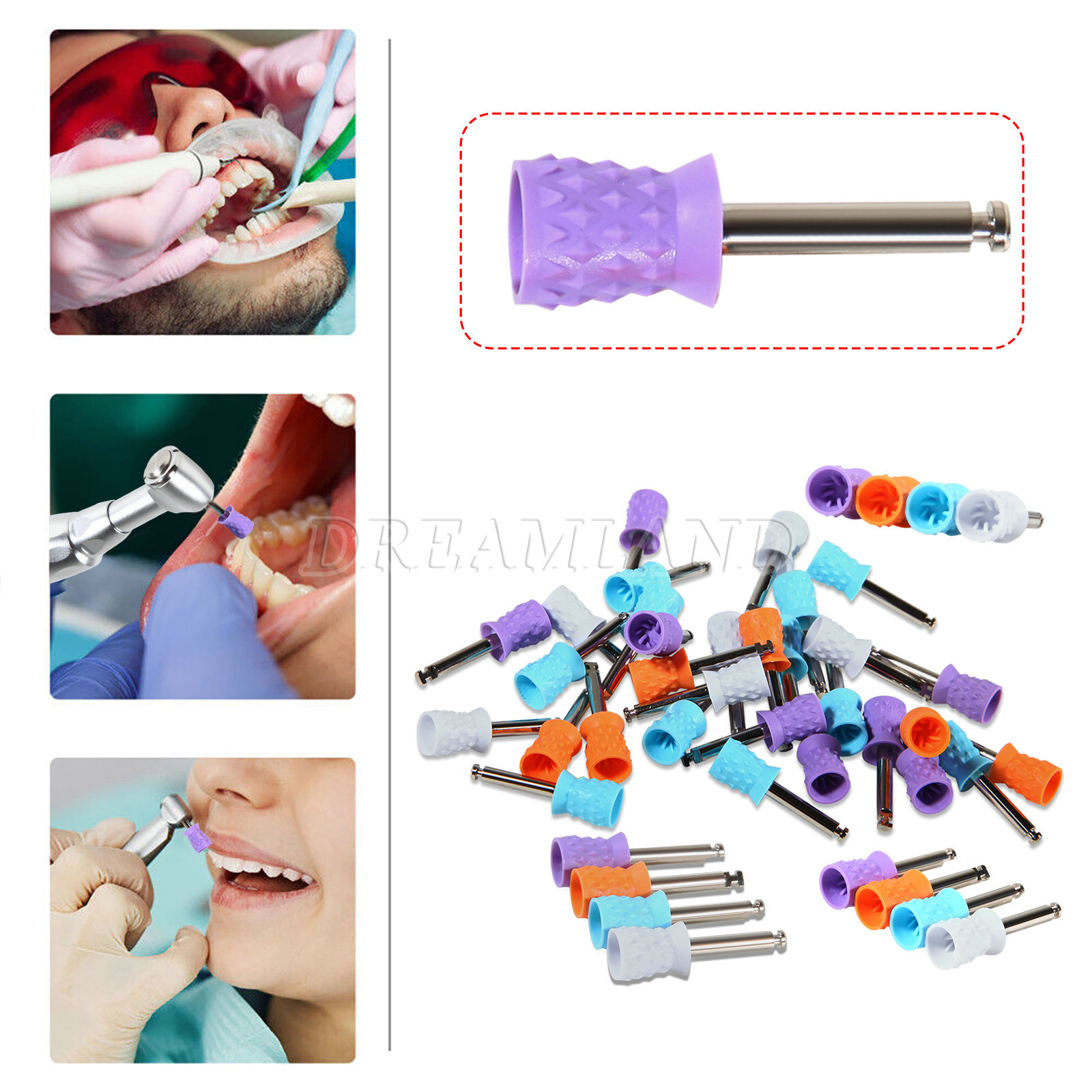 100pcs/box Dental Polishing Polish Cups Prophy Cup Latch Type