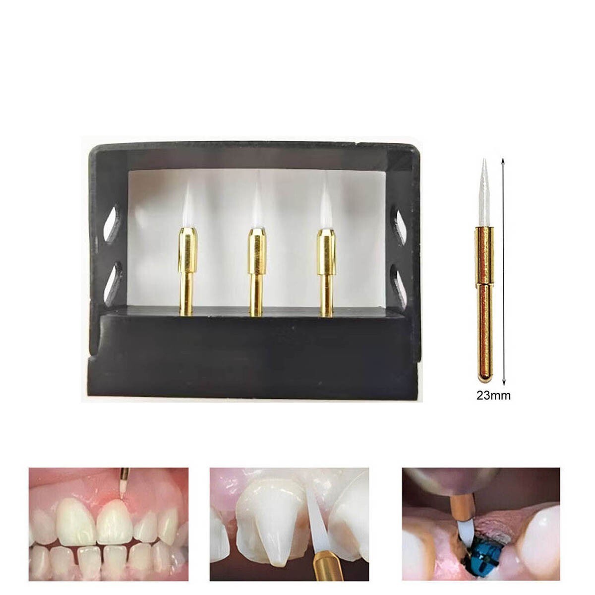 Dental Soft Tissue Trimmer Ceramic Bur Gingival Gingivectomy 21/23mm