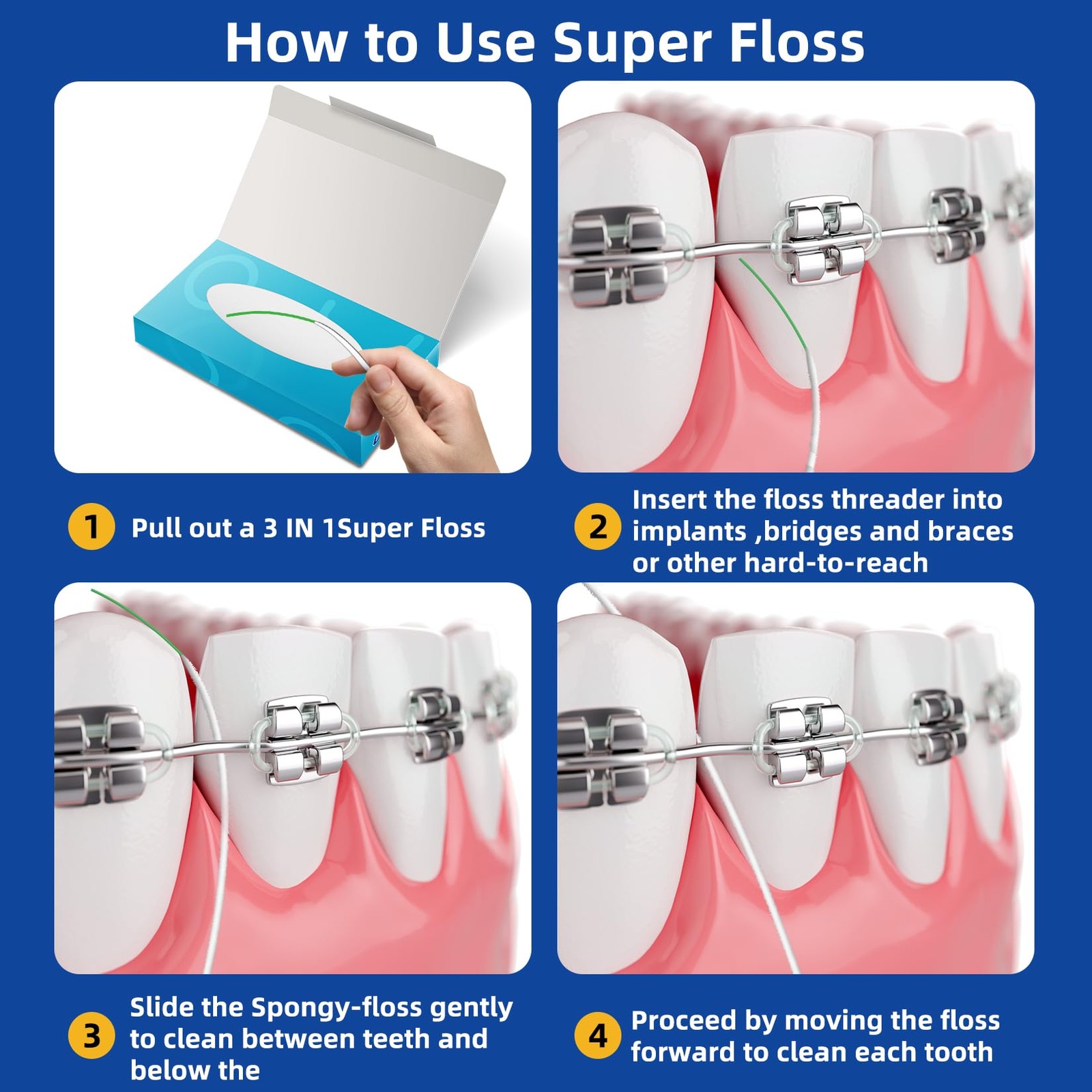 Dental Floss for Braces Floss Threaders for Bridges and Implants 80 Pre-Cut S…
