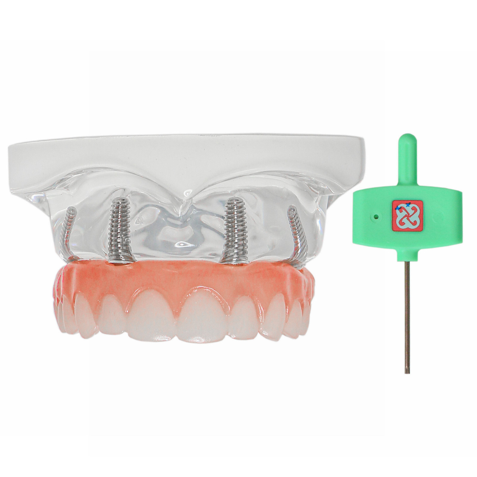 US Dental 4 Screws Overdenture Model All on 4 Restoration Upper/Lower Jaw Type