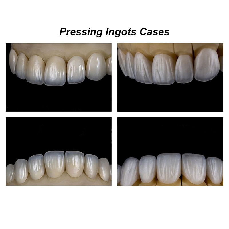10PCS Lithium Disilicate Pressing Ingots Dental Material Glass Ceramic Tablets