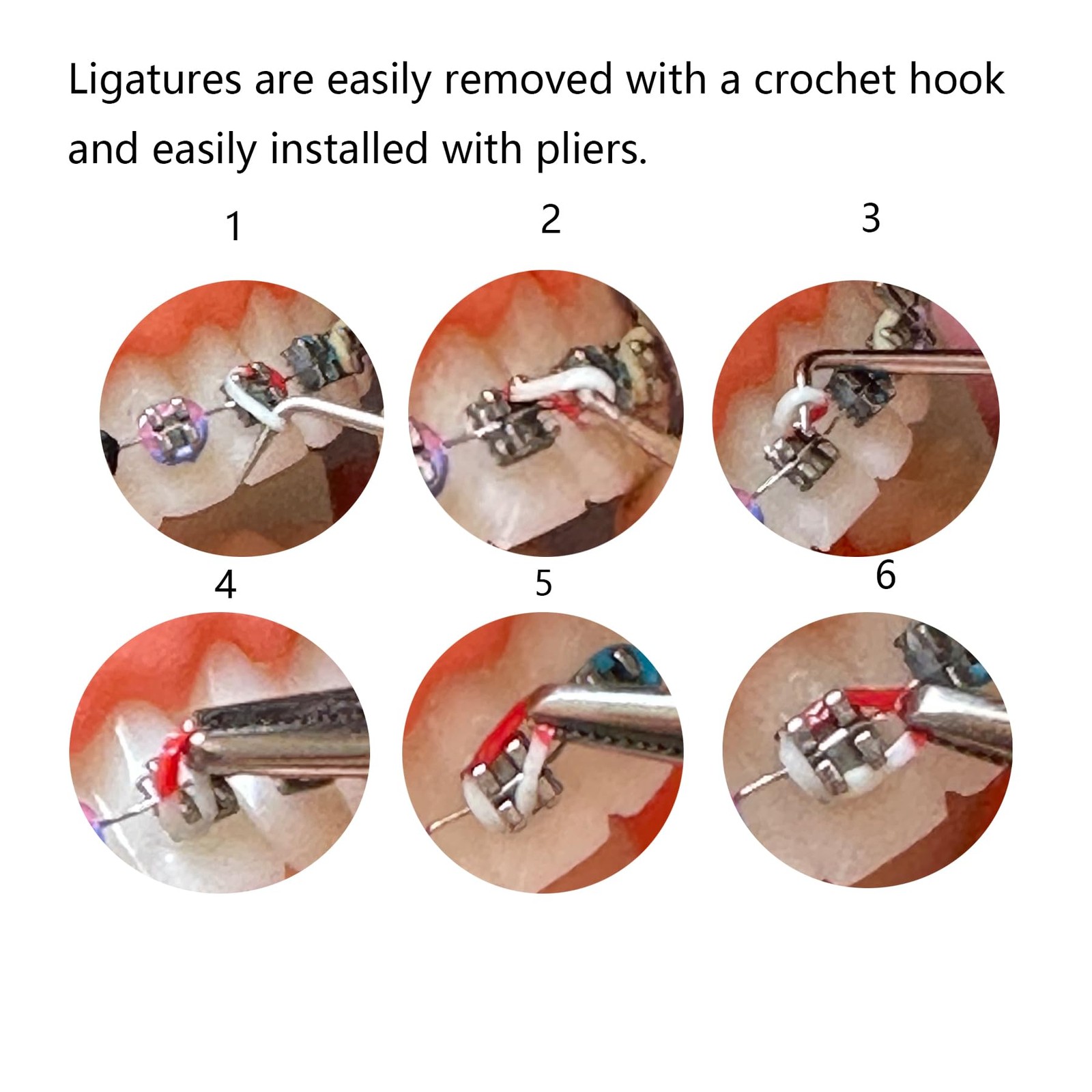Multicolor Orthodontic Ligature Ties Kit Easily Change Yourself Mixed Colors