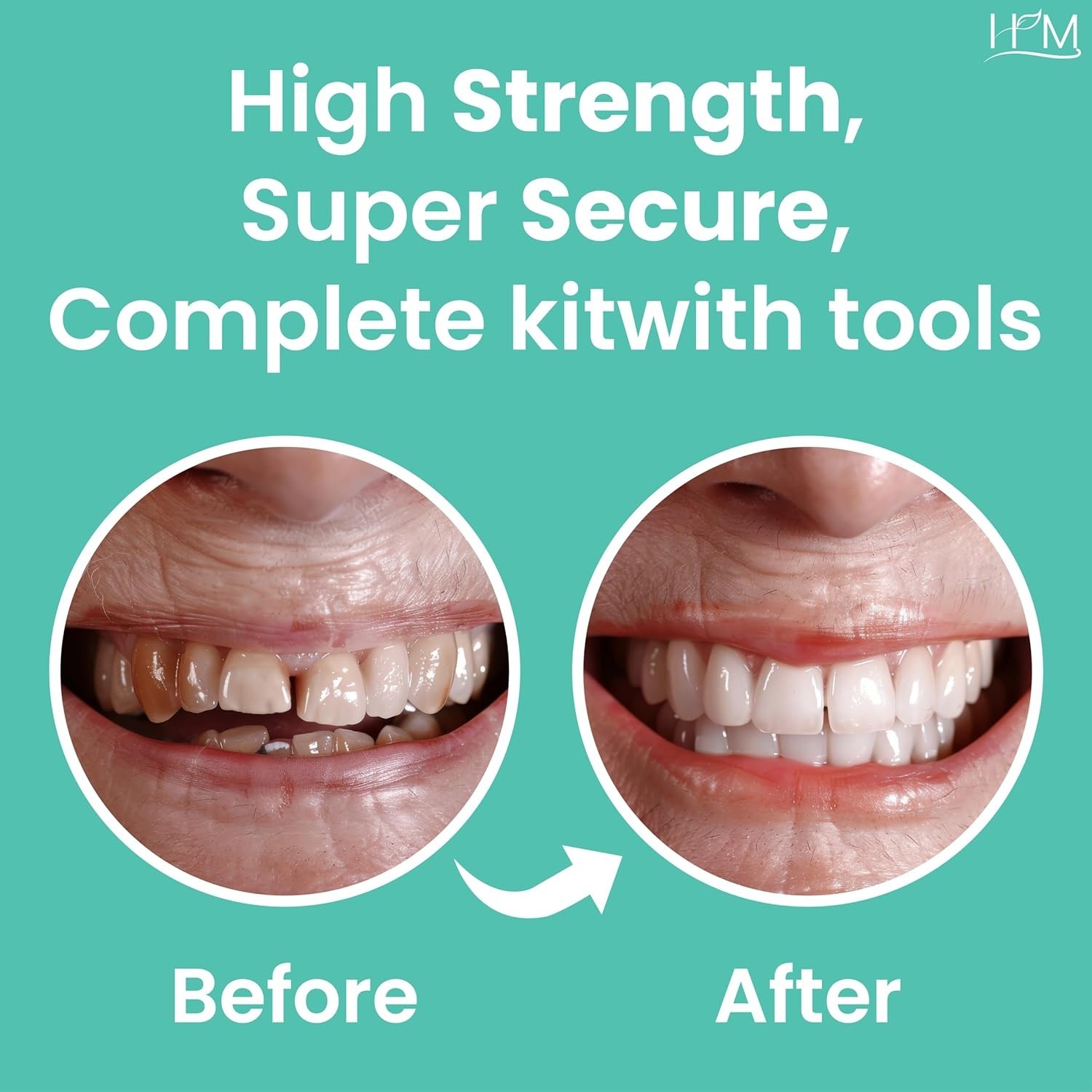 HM Zinc Oxide Eugenol Dental Cement Kit | Super Adhesive | Instant Tooth Repa…