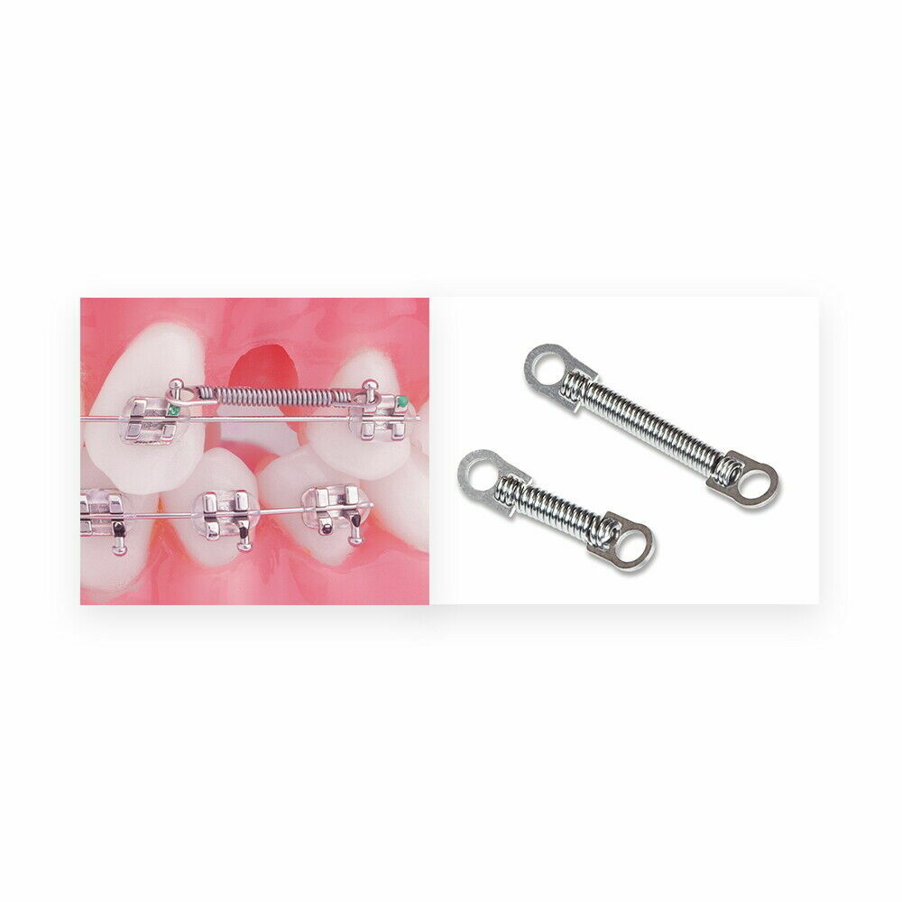 Dental Closed Coil Spring Mini Screw Implants NiTi Eyelet Orthodontic Springs