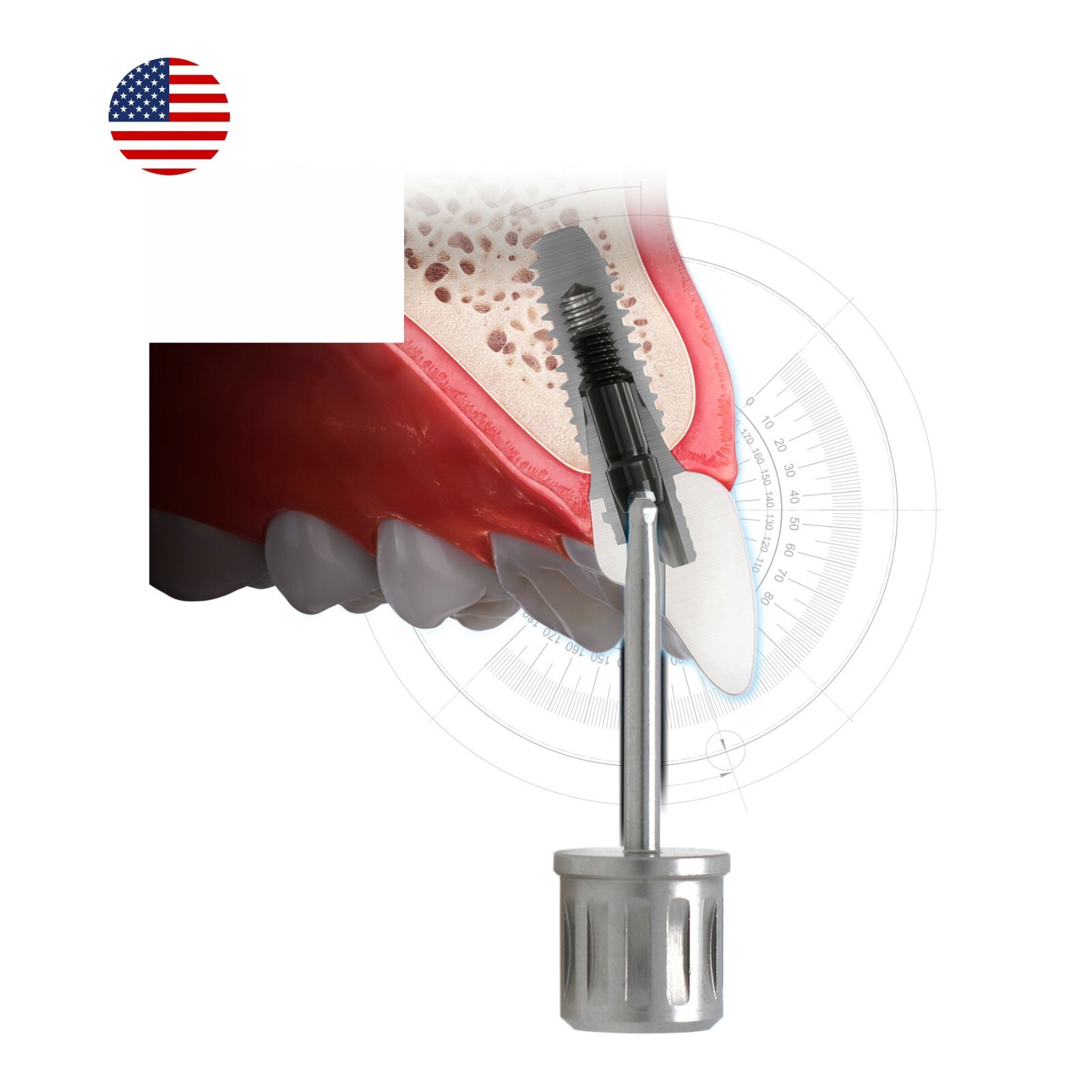 US Dental Angulated Screw Channel Screwdriver Fits Hiossen ITI Mis Nobel Astra