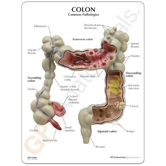 Colon GPI Anatomical Model with Key Card LFA #3340. Make Us an Offer! SEE VIDEO