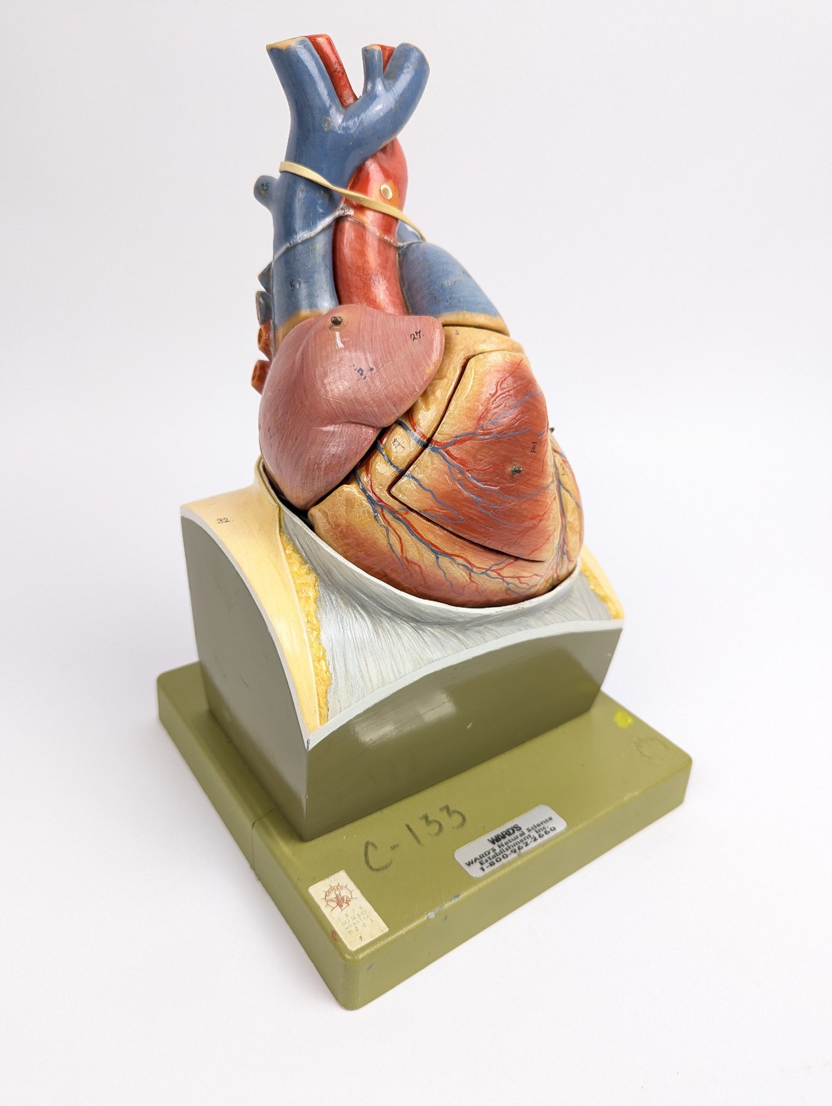 Vtg Somso Heart Model – Rare Variation (A)