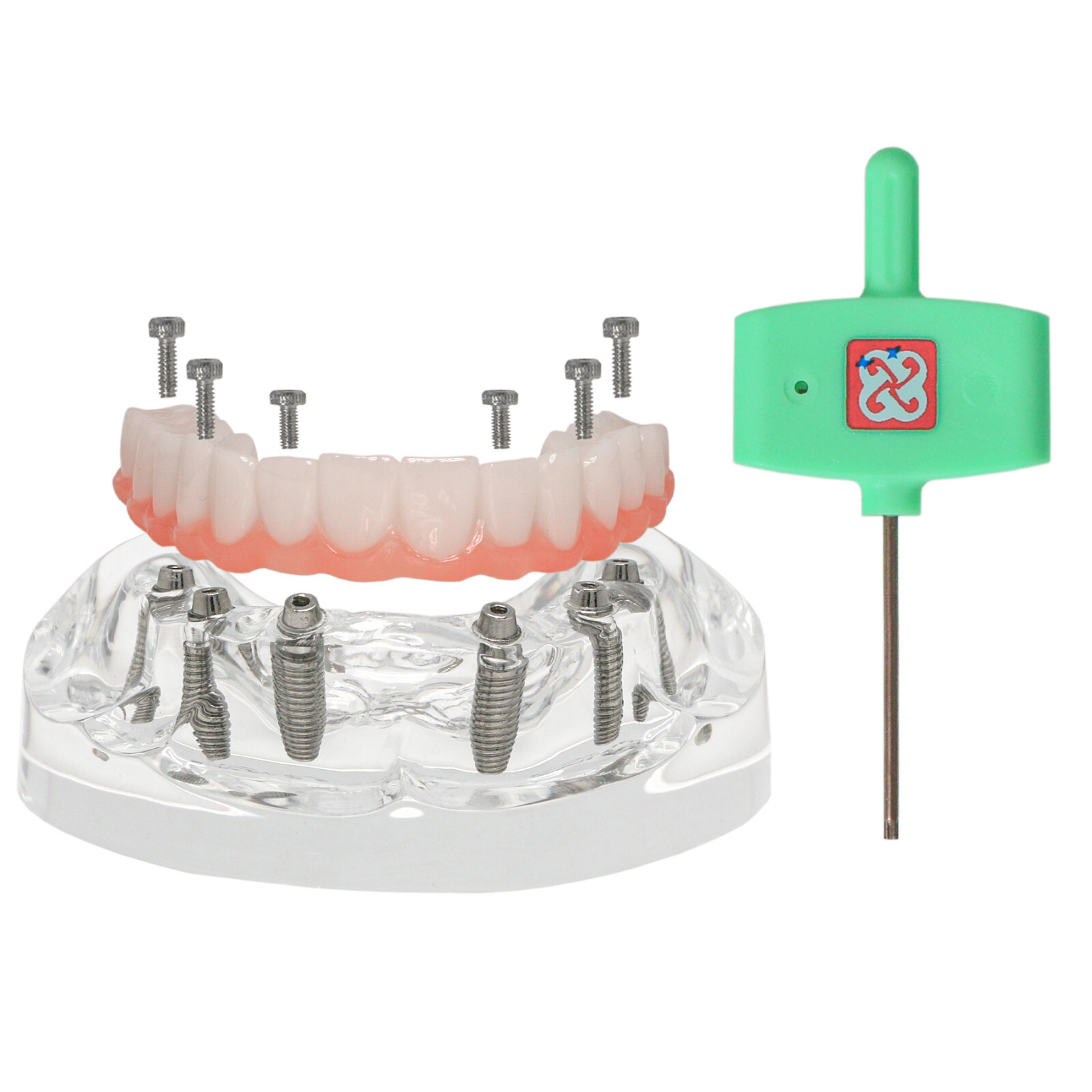 Dental Implant Model PRD Removable Partial Dentures Overdenture treatment Model