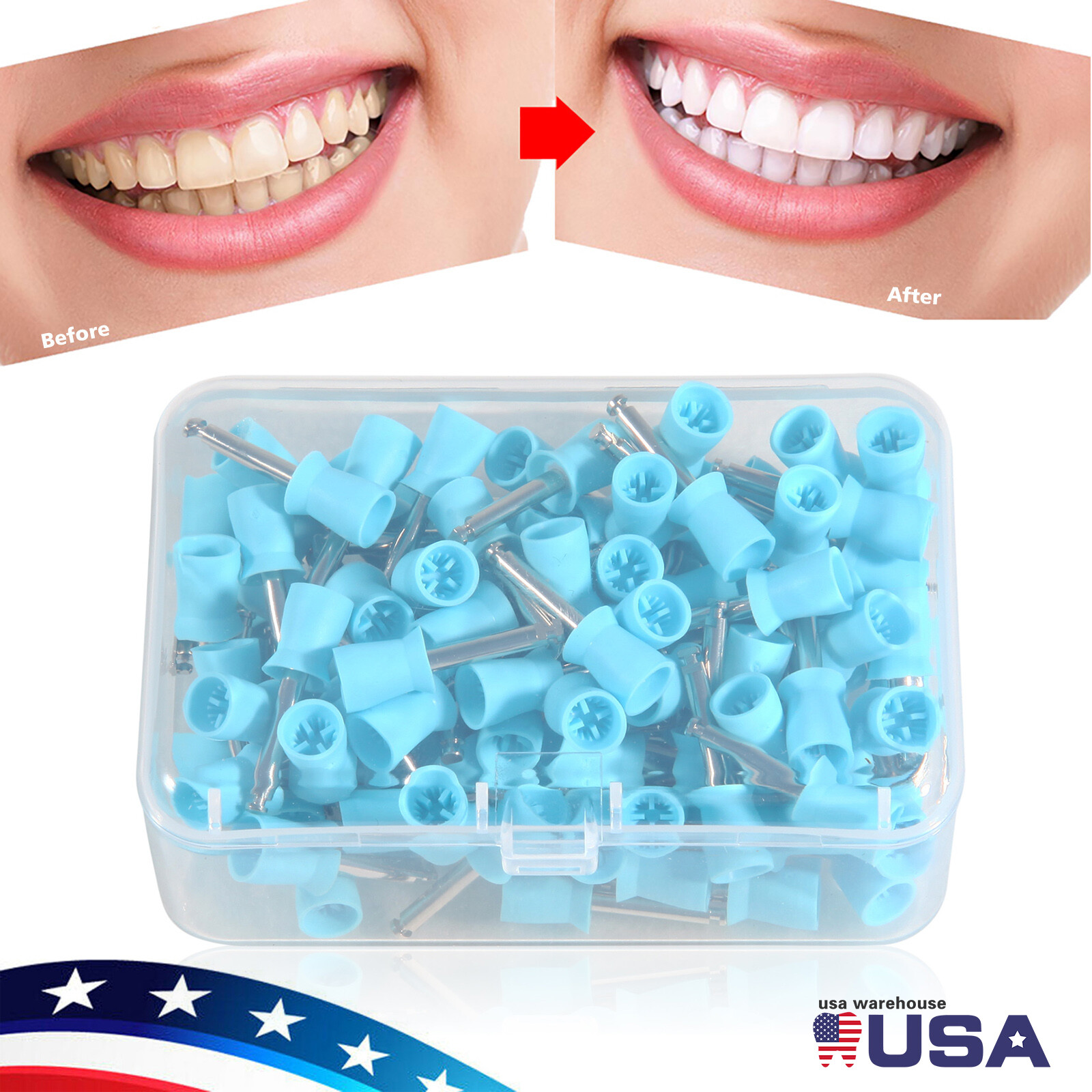 100Pcs Dental Rubber Prophy Cups Teeth Polish Polishing Latch Type Blue Kit USA