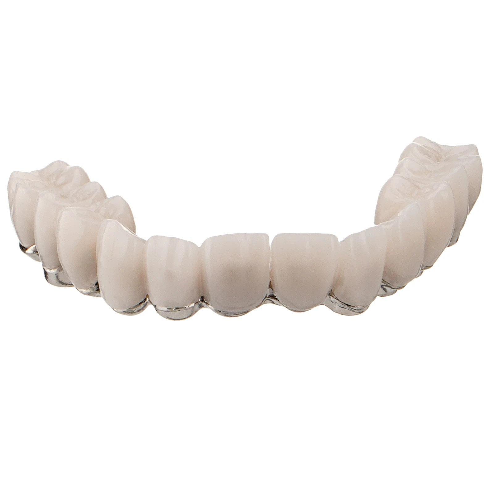 Upper Jaw Dental All-on-4 Overdenture Model Dental Implants Restoration 4 Screws