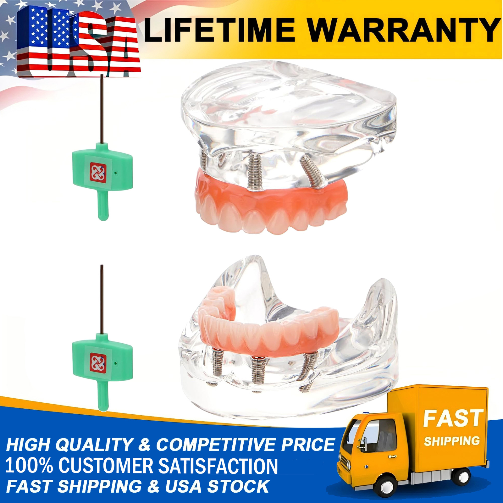 US Dental Overdenture Implant All-on-4 Dental Implants Model Upper & Lower Jaw