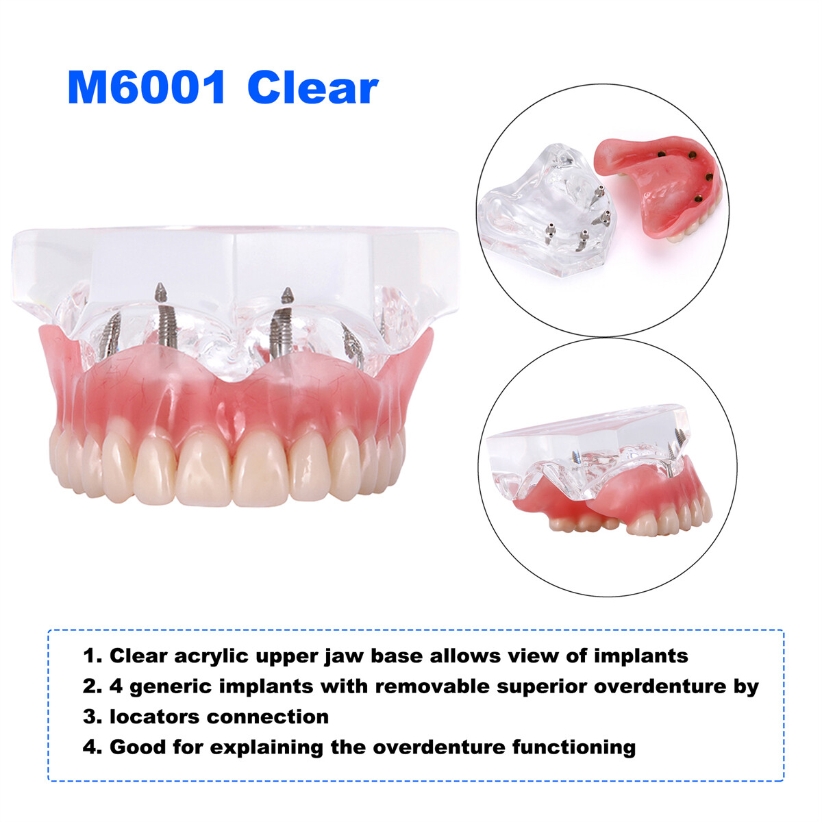 US Dental Teeth Model Ortho Implant Pathological Perio Practice Demo Study Model