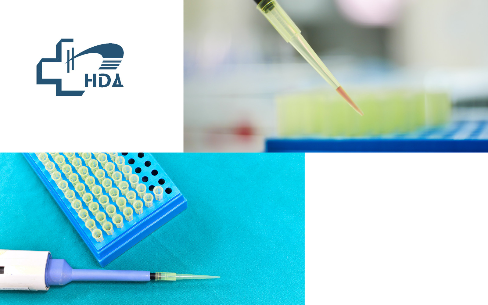 HDA Universal Yellow Pipette Tips 200ul Lab Liquid Pipette Tips – 1000 Pcs.