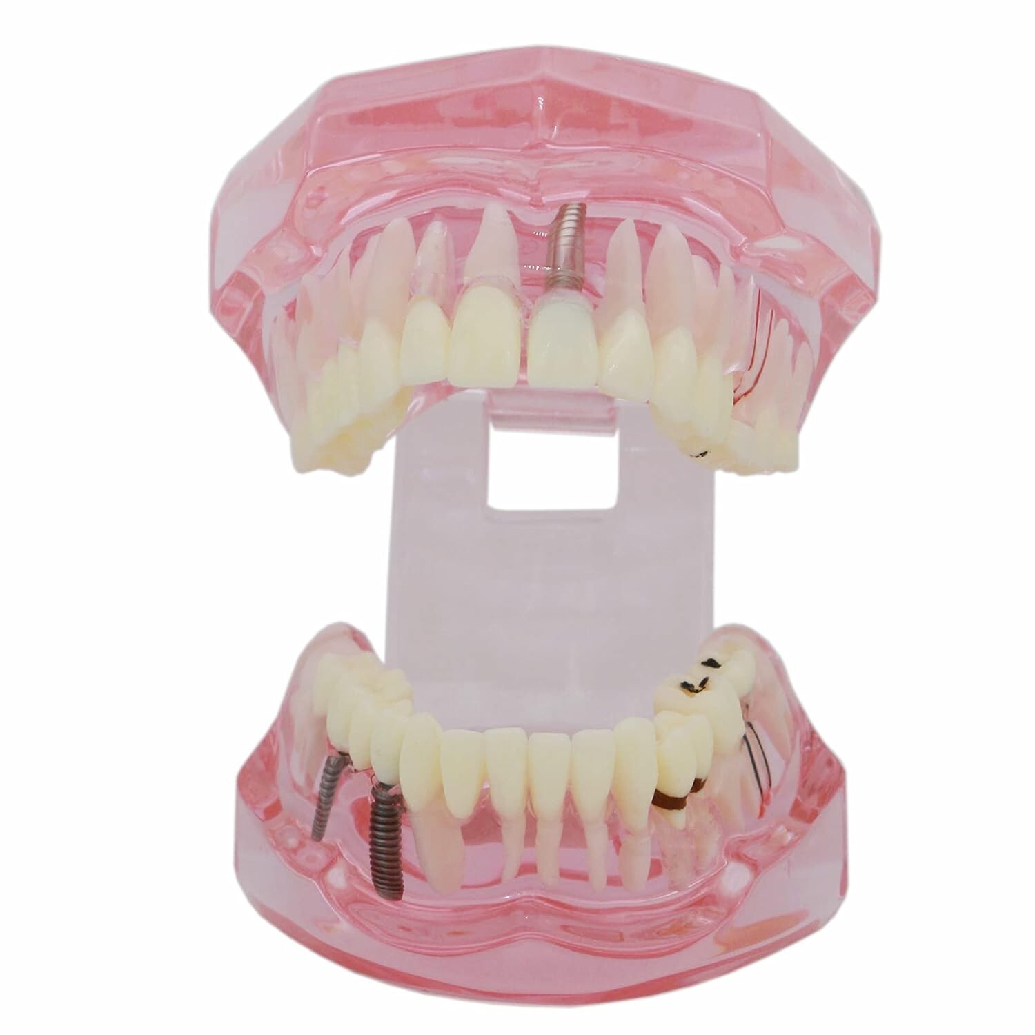 Dental Teeth Model Teach for Study Demo Restoration Pathology Bridge M2001 Pink