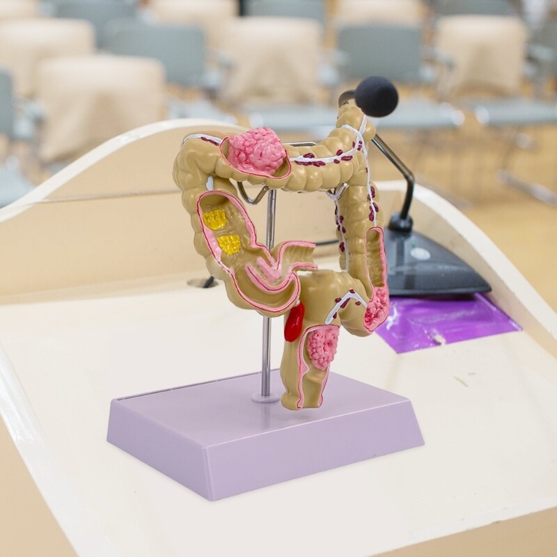 Human Large Intestine Model Teaching Model Medicals Supplies for School Study