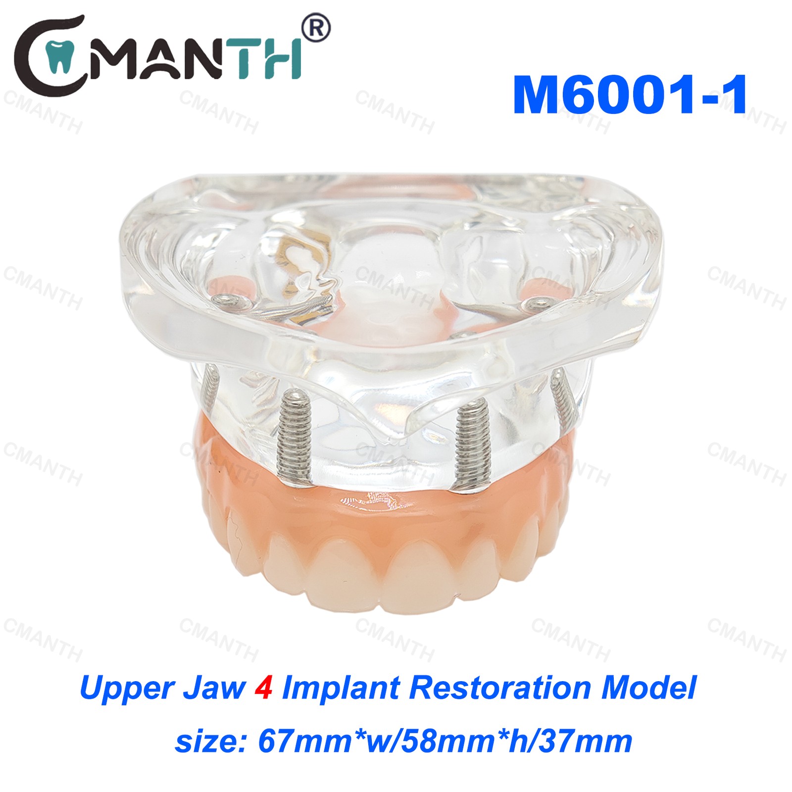 Dental Teeth Model Orthodontic Model Teaching Studying Implant Models Dental Lab