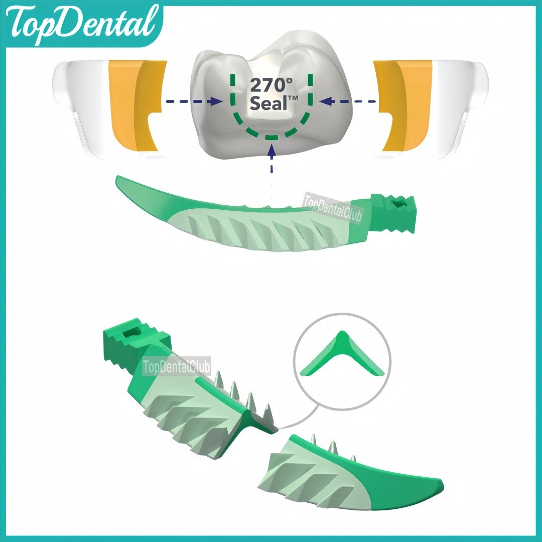 Dental Composite Wedge Strata Wedges Soft Face Cervical Seal Diastema Matrix SML