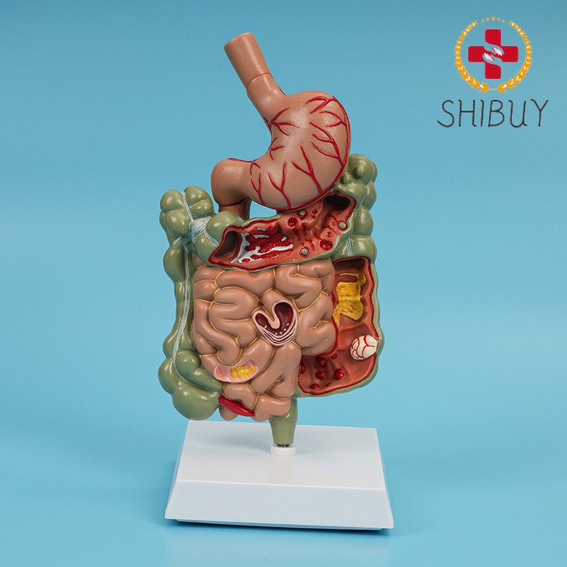 Digestive System Stomach Anatomy Small Large Intestine Colon Anatomical Model