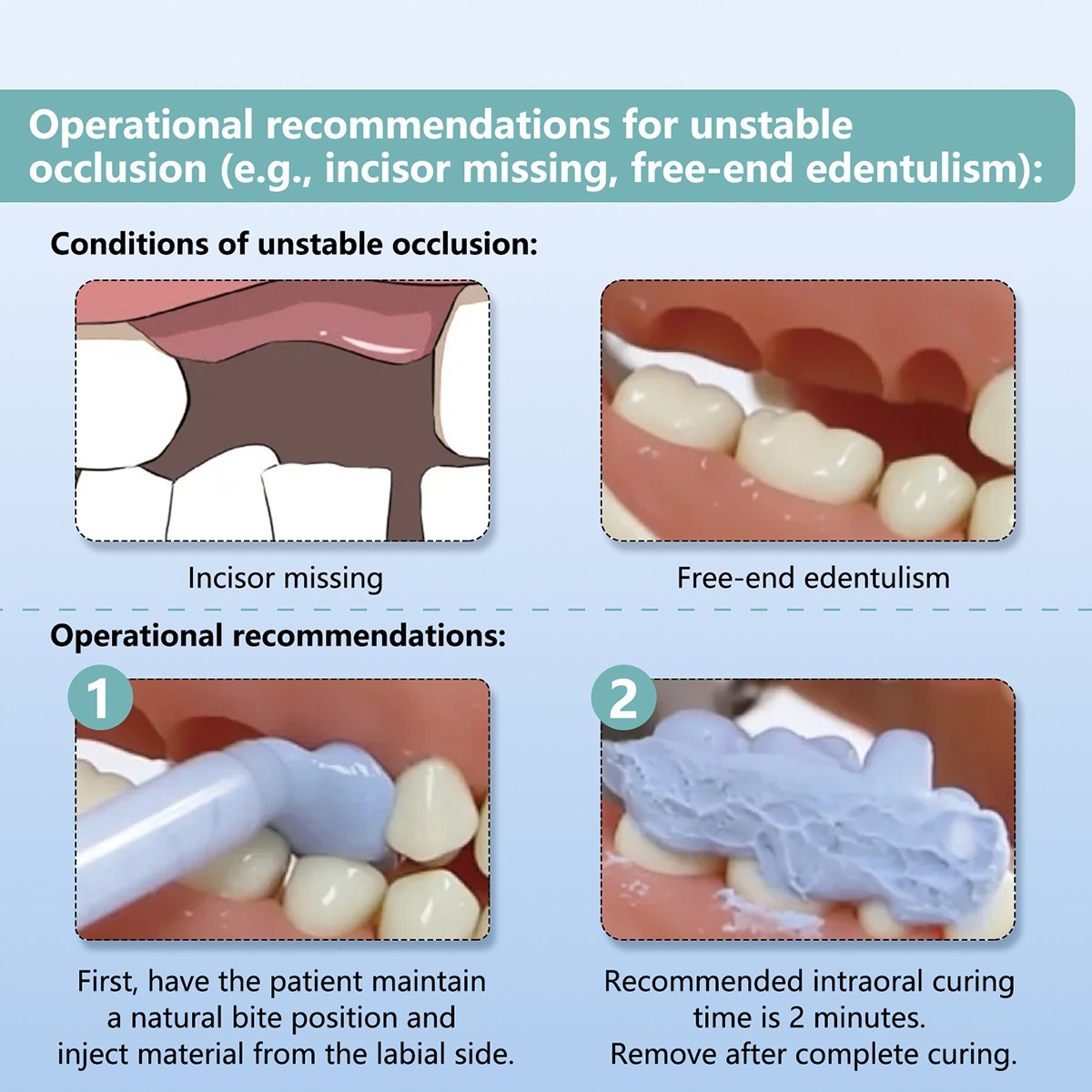 Dental Bite Registration Material Fast Set A-Silicone for Bite Registration