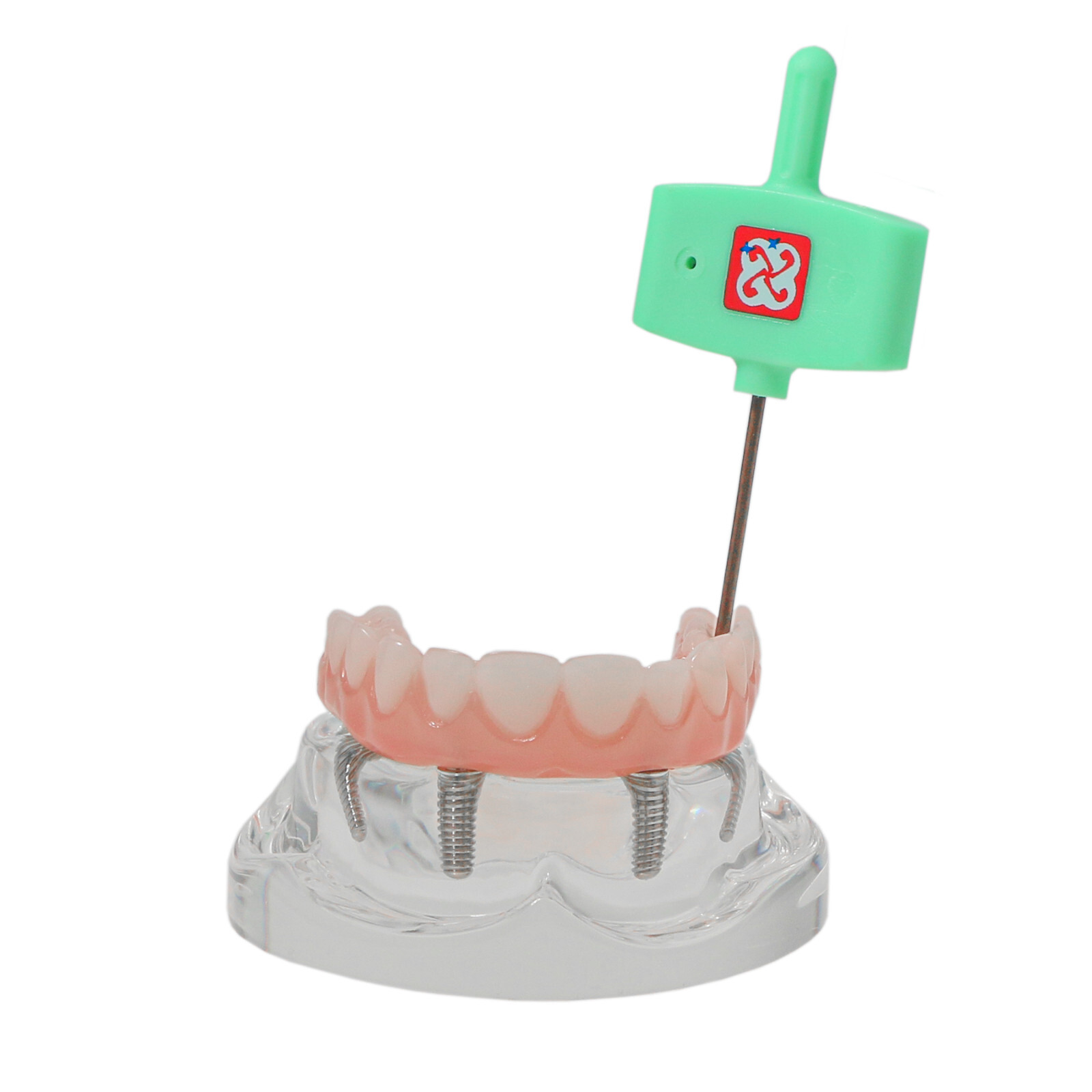 US Dental 4 Screws Overdenture Model All on 4 Restoration Upper/Lower Jaw Type