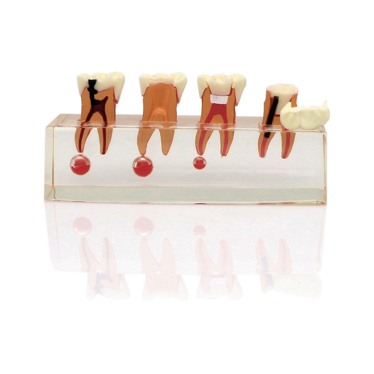 US Dental Teeth Model 4-Stage Molar Root Canal Caries Endodontic Treatment Study