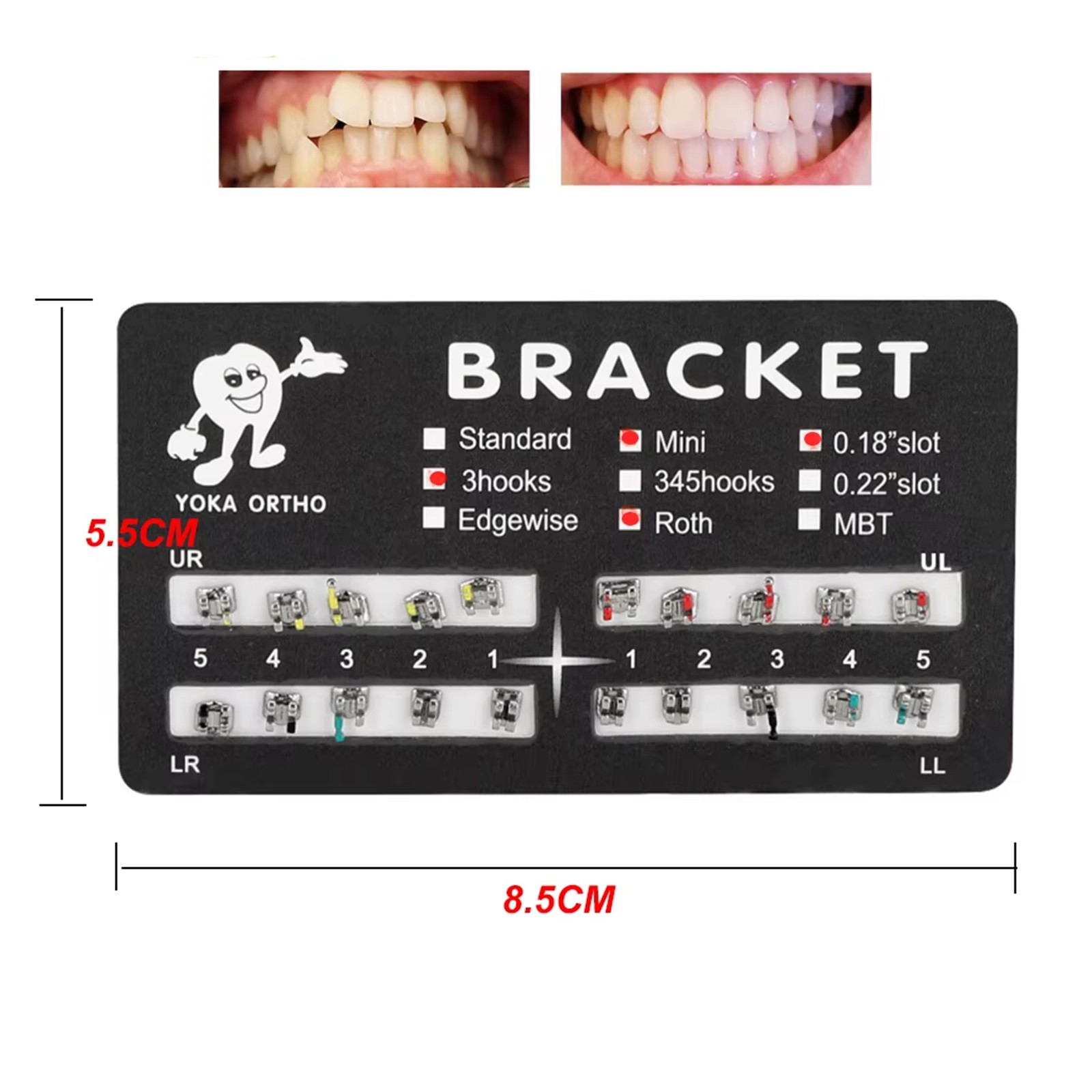 NSK Ti-MAX X95L Style Dental 1:5 LED Fiber Optic Contra Angle Handpiece Brackets