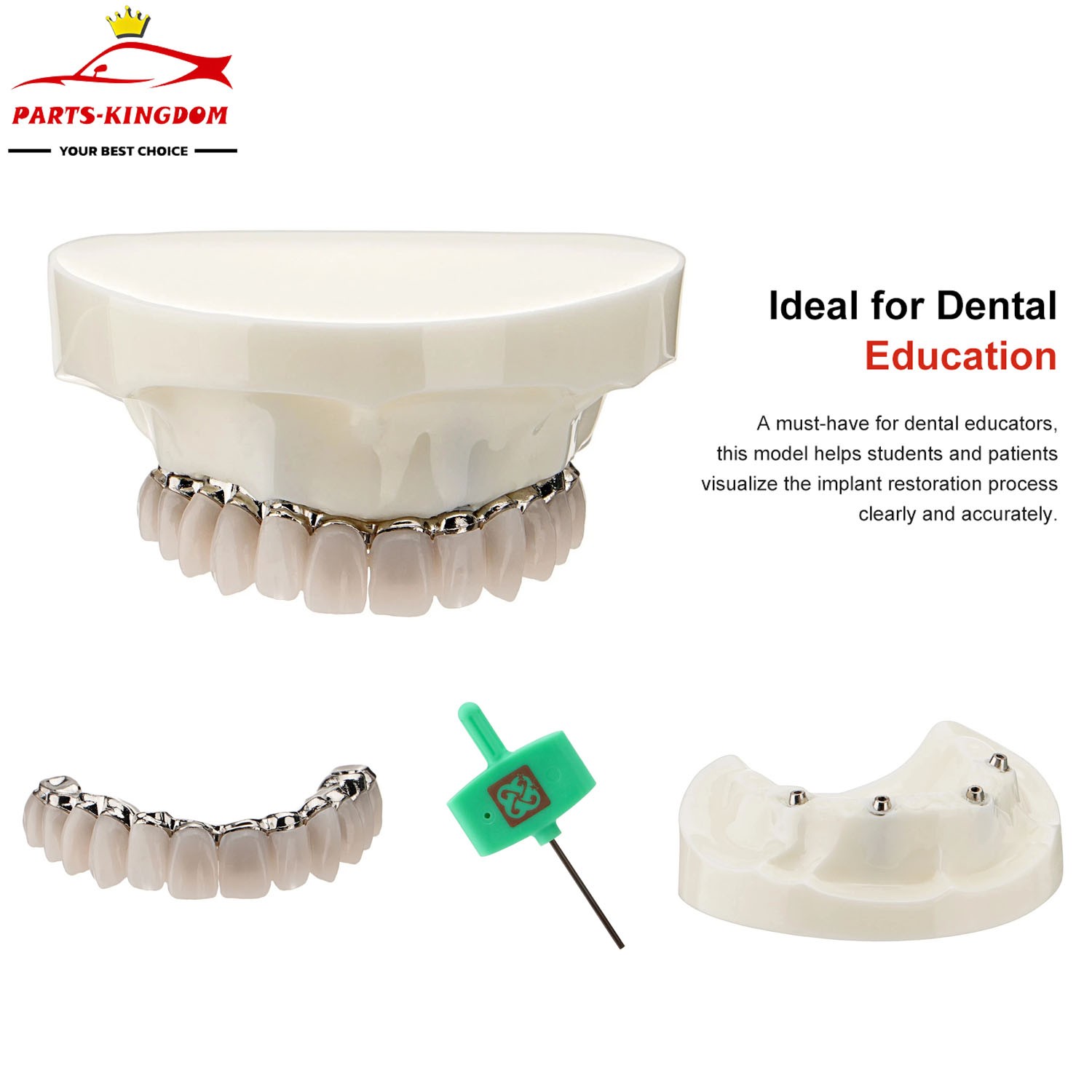 Dental All-on-4 Overdenture Model Dental Upper Jaw Implants Restoration 4 Screws