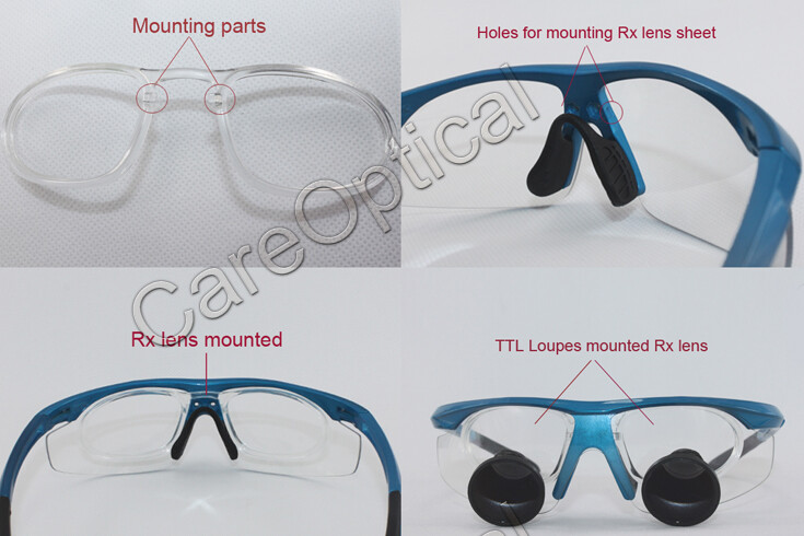 custom made TTL loupes dental loupes surgical loupes 3.5X Sports frames