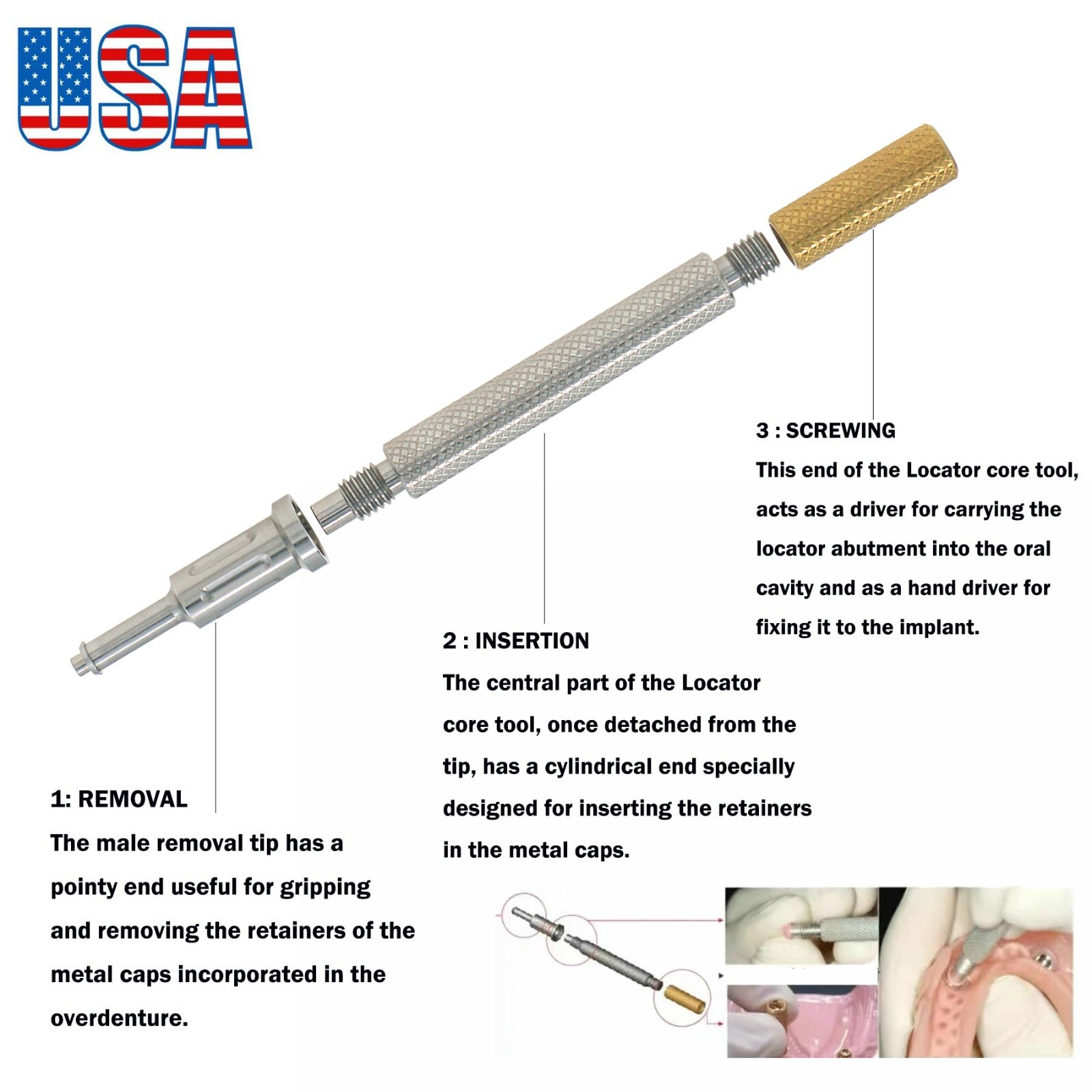 US Dental Attachment Abutment Male Cap for NOBEL Biocare Nobel Active Conical RP
