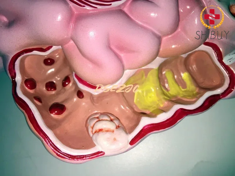 Adult Human Digestive System Large Intestine Model Duodenal Visceral Model