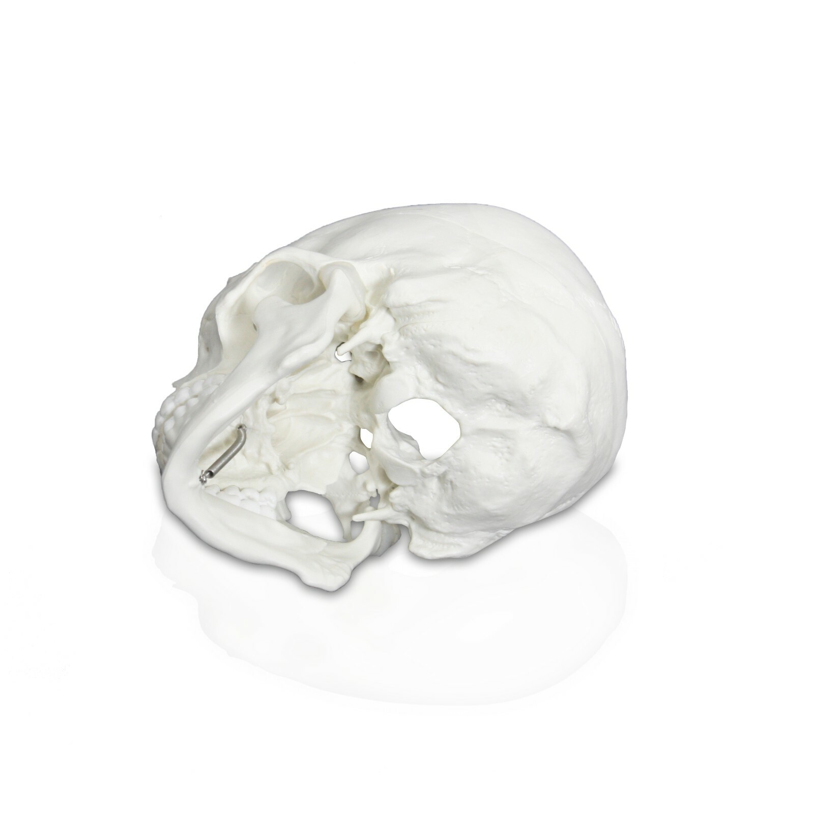 Vision Scientific VAL207-A Life-Size Human Skull | 3 Parts | Medical Grade