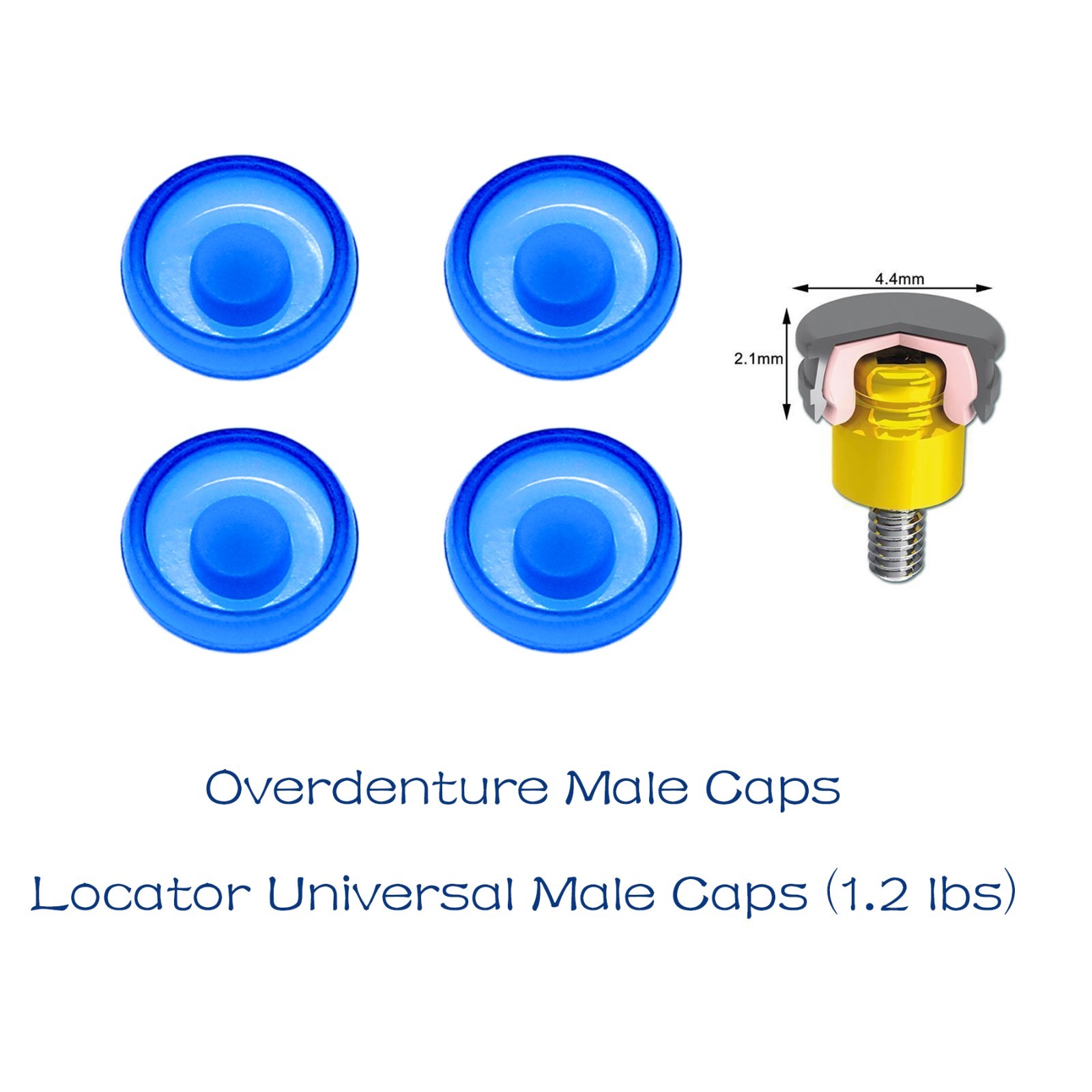 US Dental Locator Universal Male Retention Caps Inserts Bule Extra Light 1.2Lbs