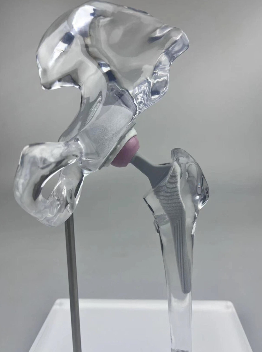 Transparent 1/3 Artificial Hip Joint Replacement Medical Anatomical Demo Model