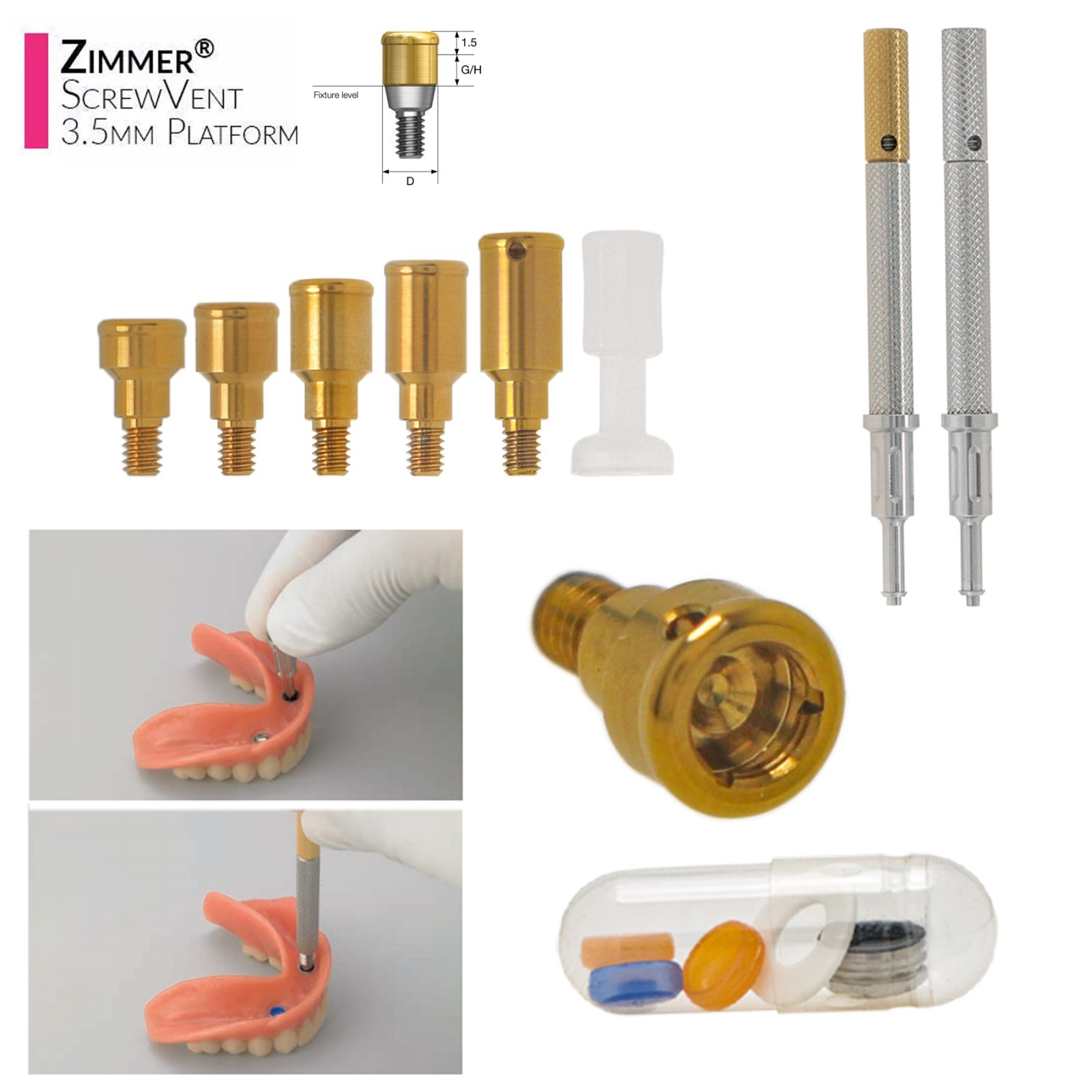 US LOCATOR Abutment Compatible with the ZimVie /Zimmer Biomet Tapered Screw Vent