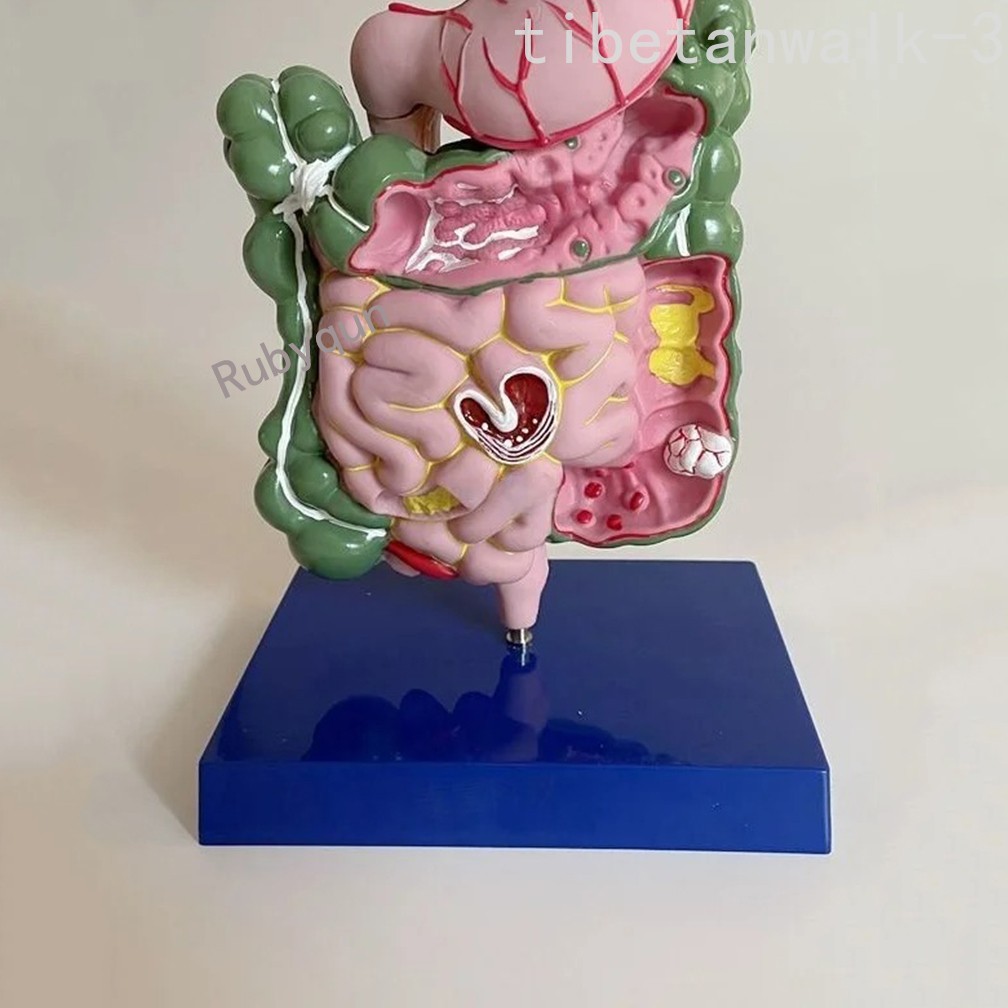 Human Digestive System Model Stomach Esophagus Stoh Large Small Intestine Ileum
