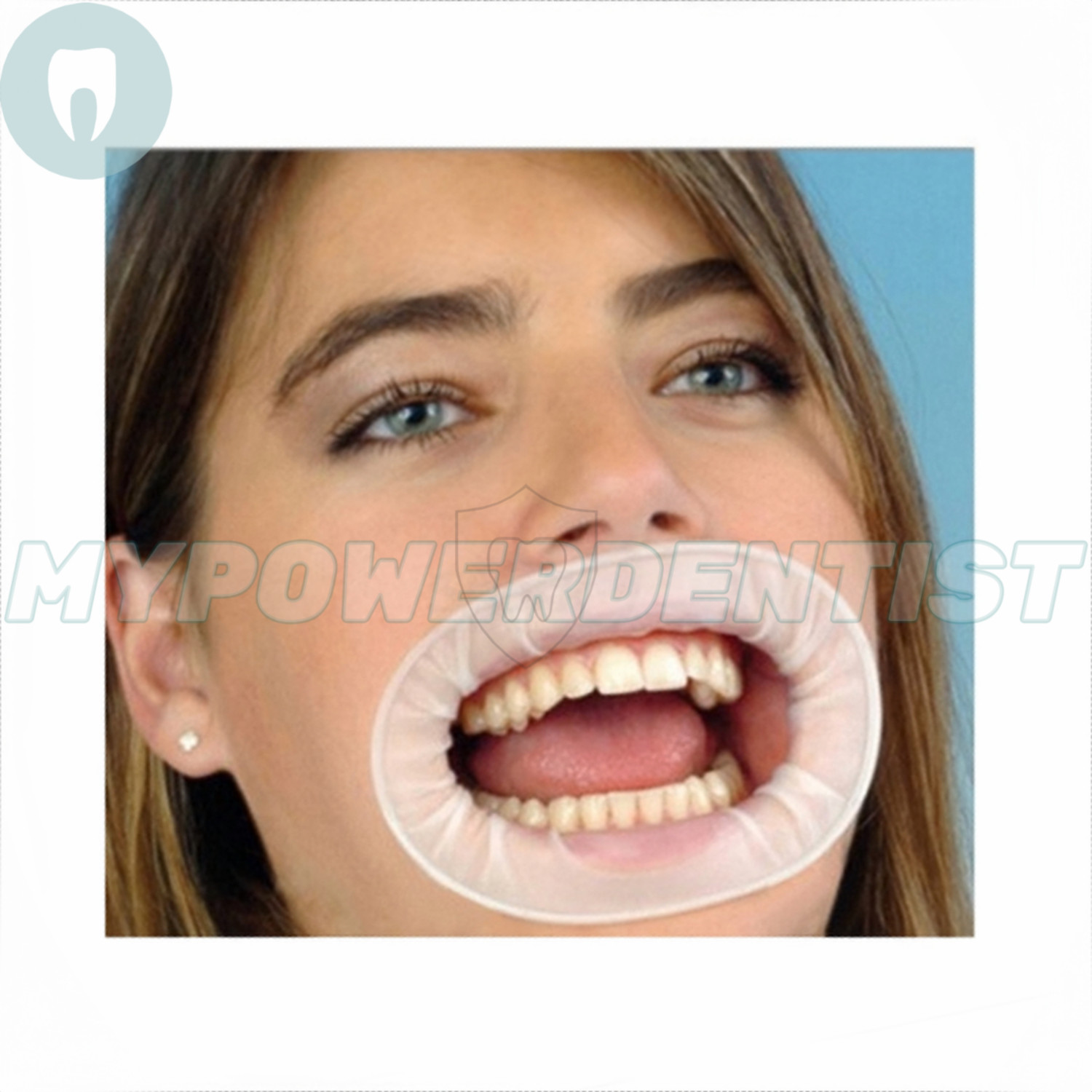 Dental O Shape Mouth Opener Lip Cheek Retractors Intraoral Lip Expander Opener