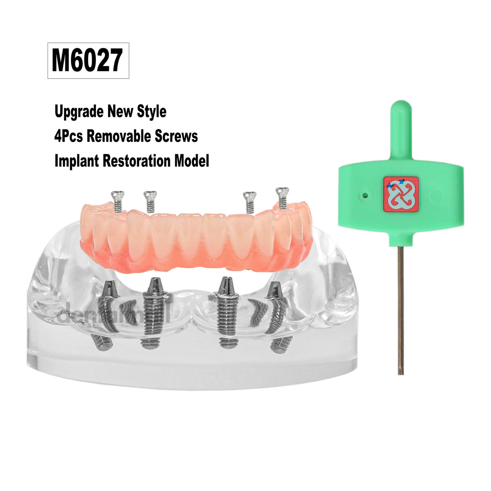 US Dental 4 Screws Overdenture Model All on 4 Restoration Upper/Lower Jaw Type