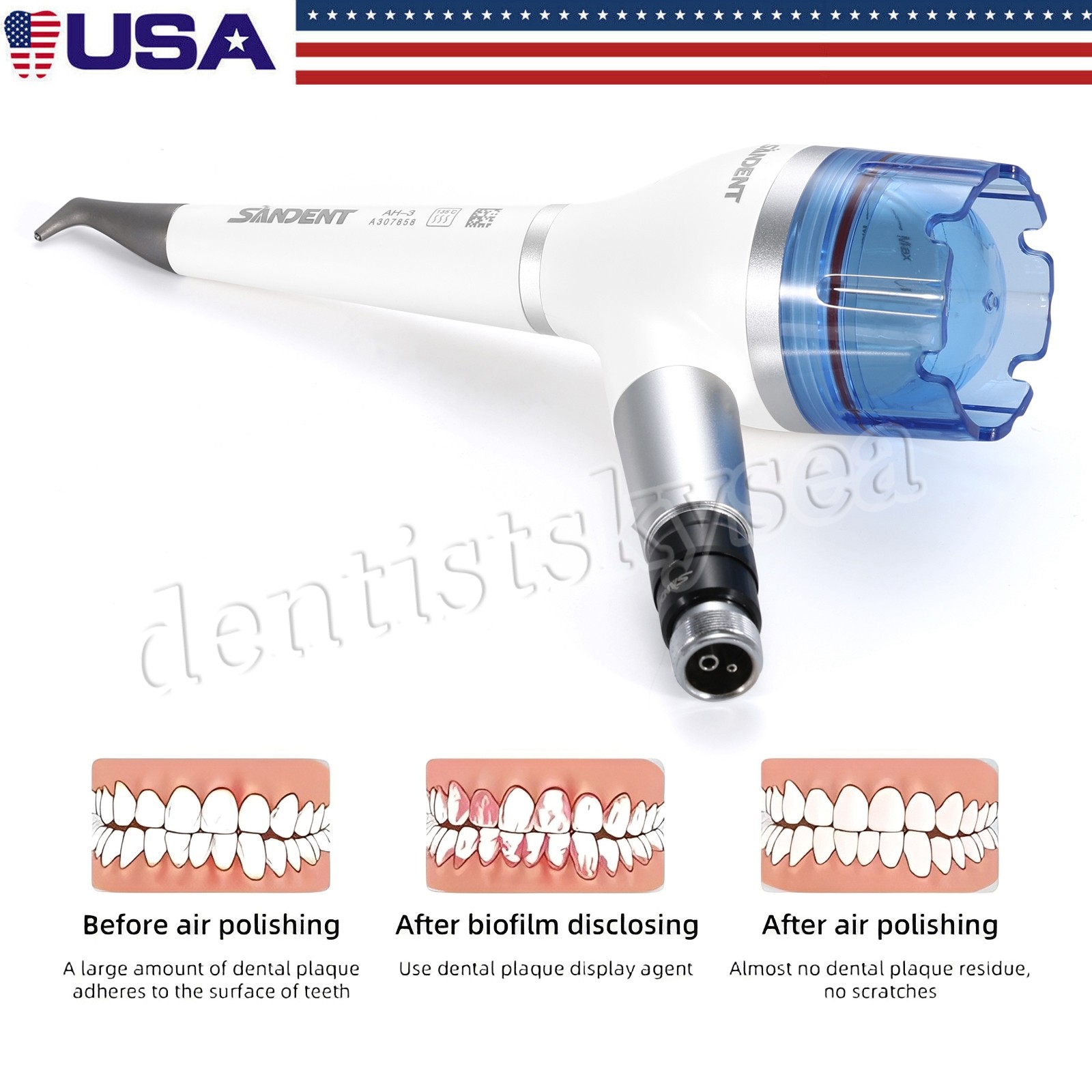SANDENT Prophy Air Flow Prophy Handpiece Teeth Polishing 4Hole/2Hole