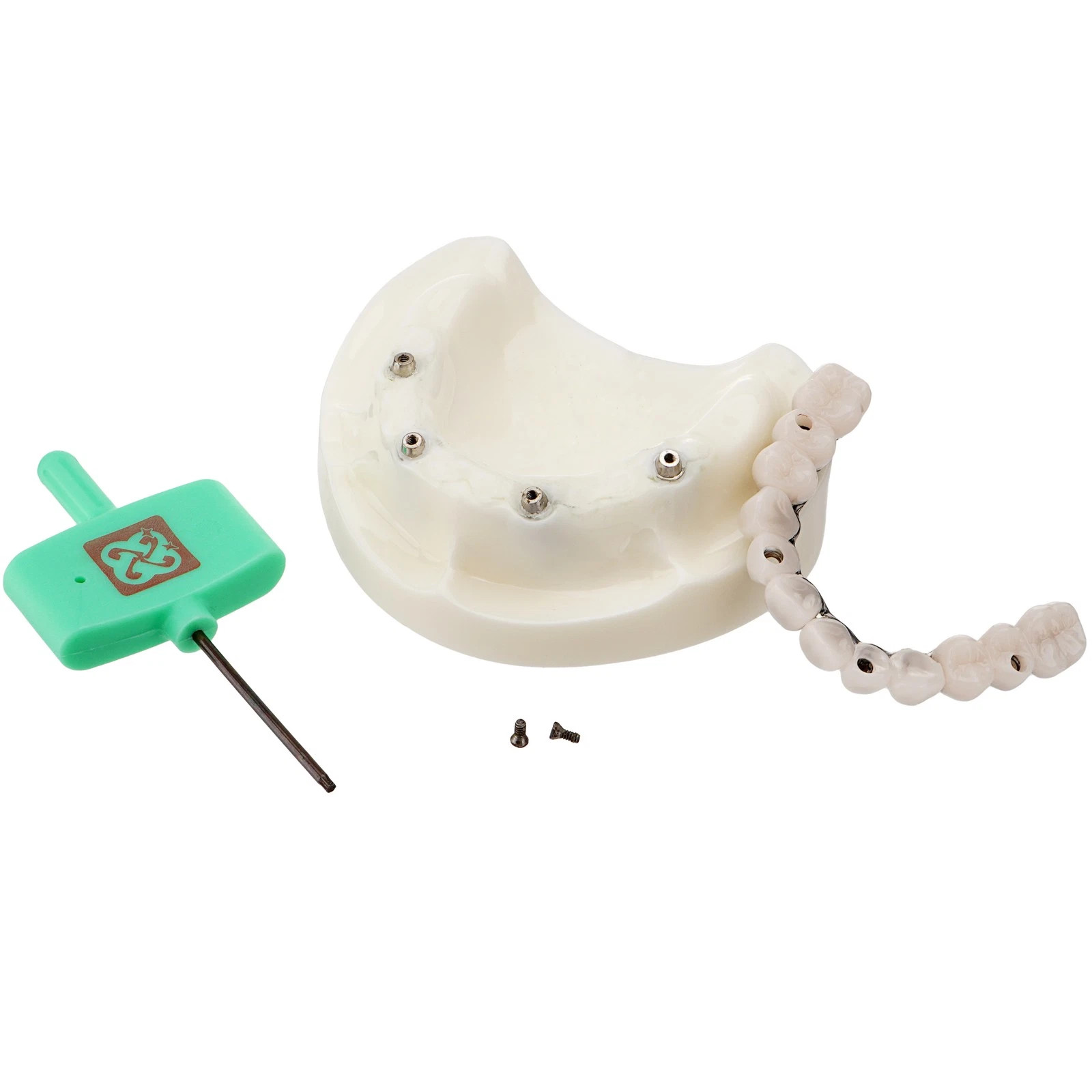 Upper Jaw Dental All-on-4 Overdenture Model Dental Implants Restoration 4 Screws