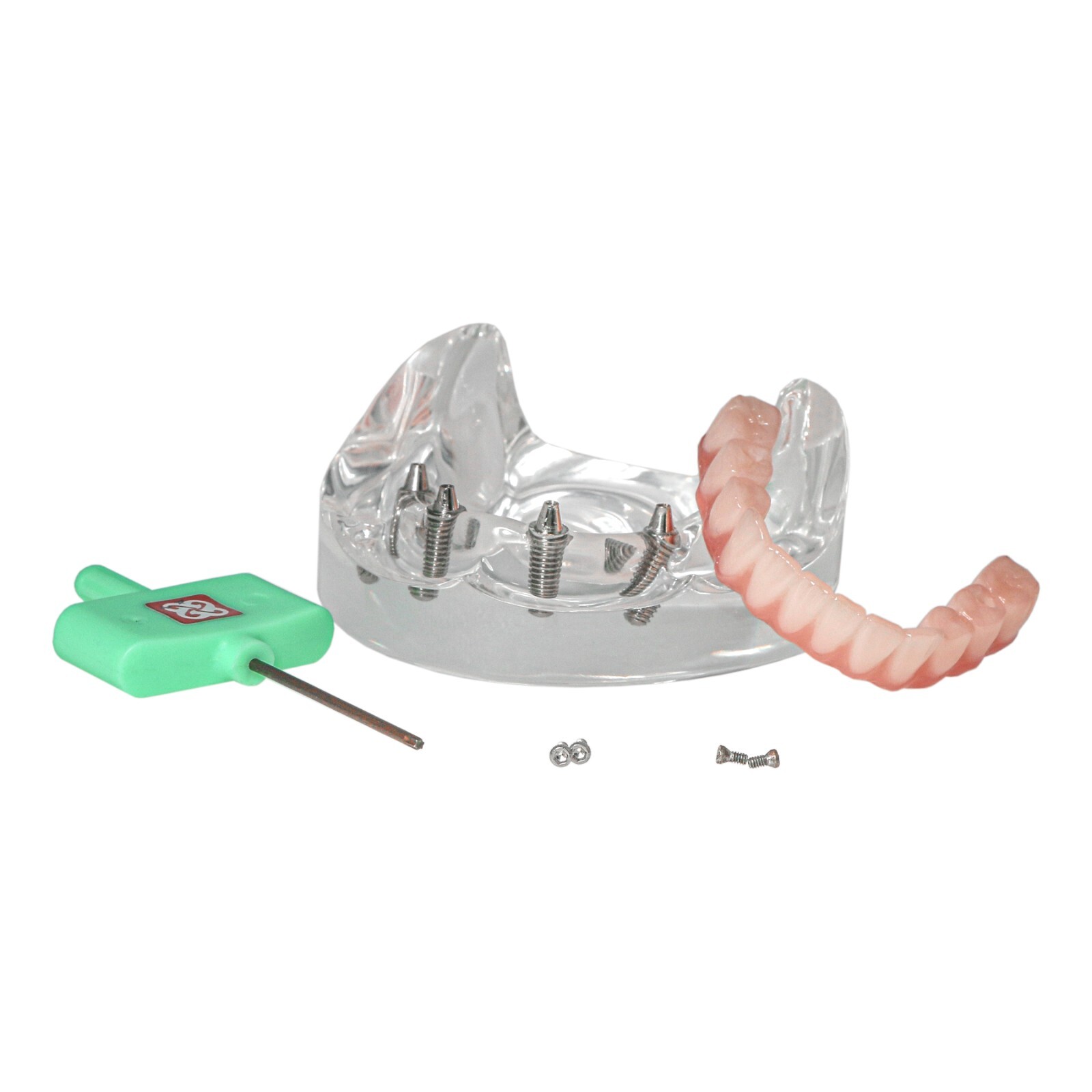 Dental Implant Overdenture Model Upper Lower Jaw Teeth Model with 2/4/6 Screws