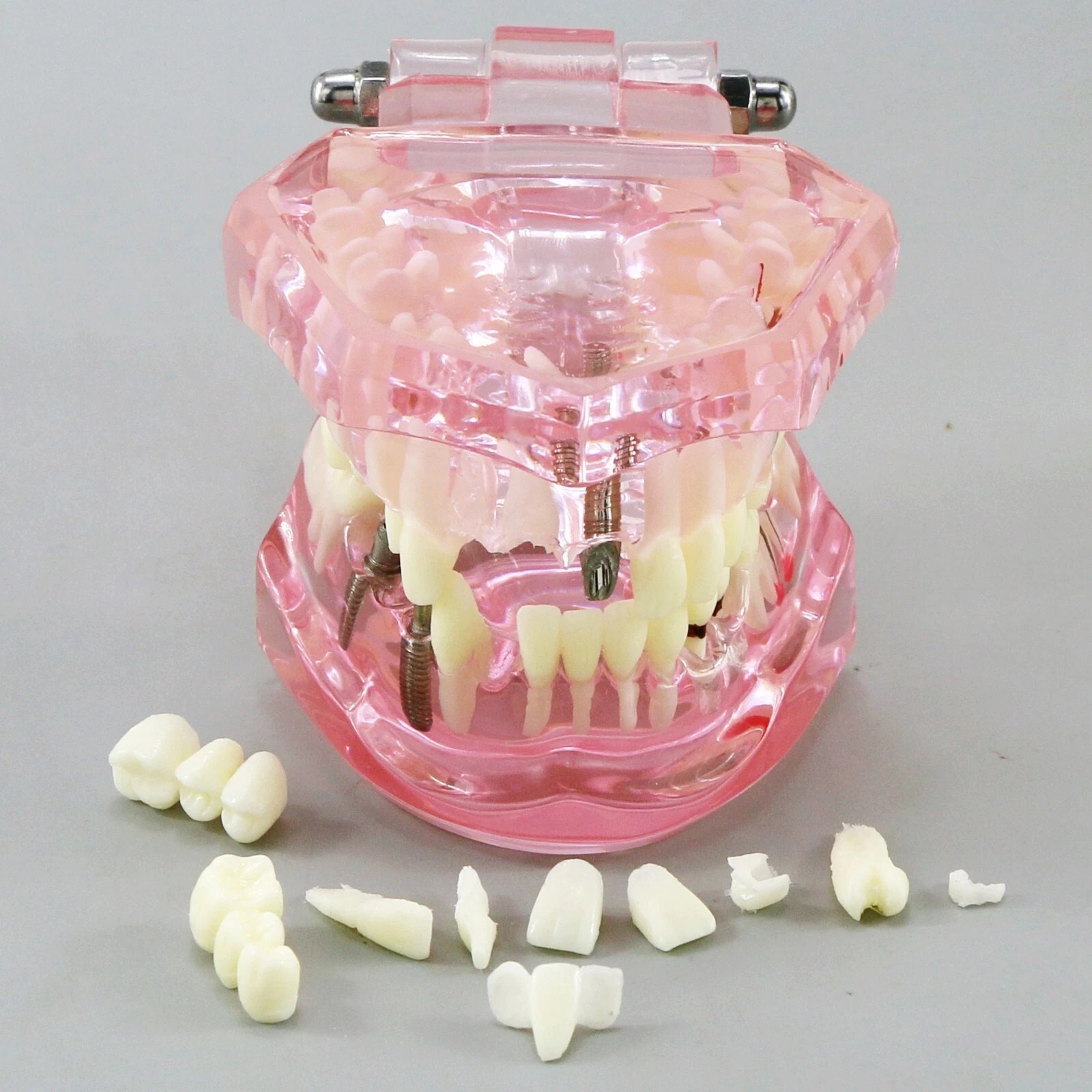 Dental Implant Teeth Model Teach Study Demo Restoration Pathology #2001 Pink