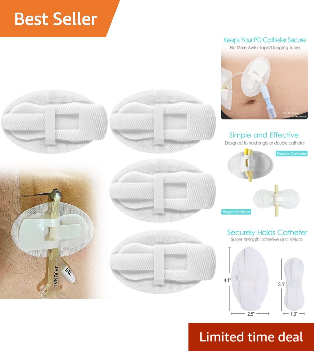 Hypoallergenic Adhesive Catheter Holders for Safe Tube Management