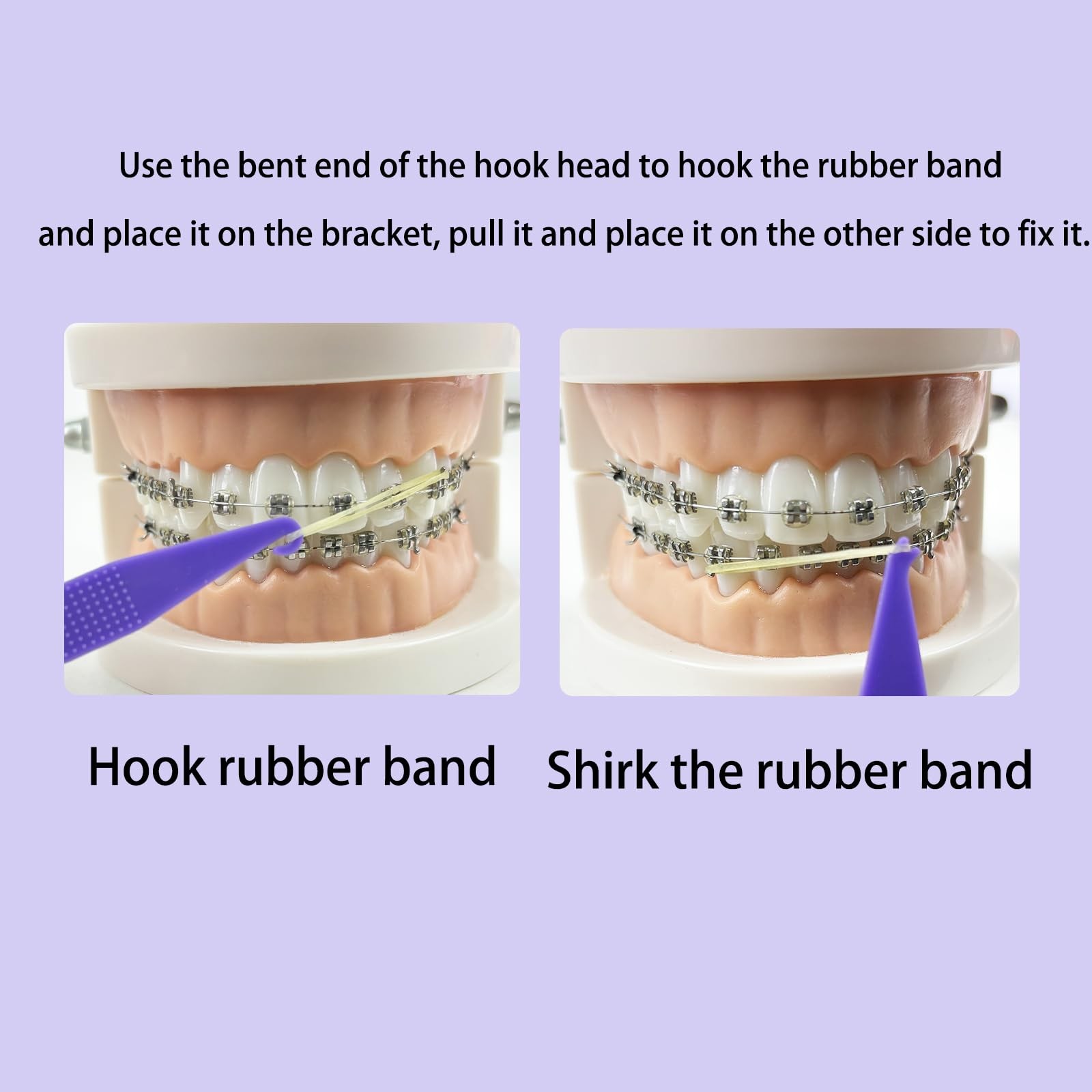 100PCS Elastic Rubber Bands Placers Tool for Braces,Colorful Disposable Plast…